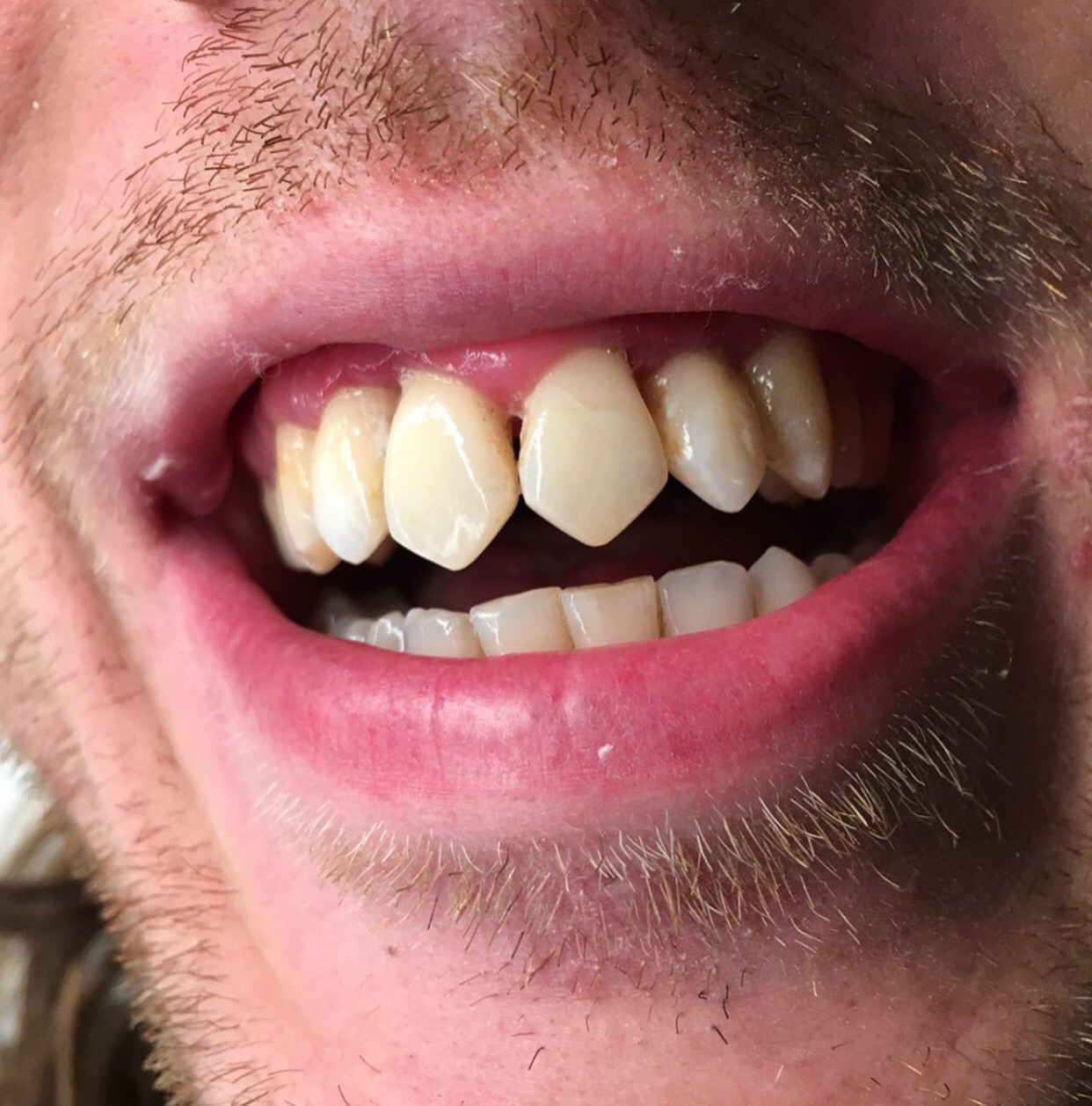 @Brassturtle