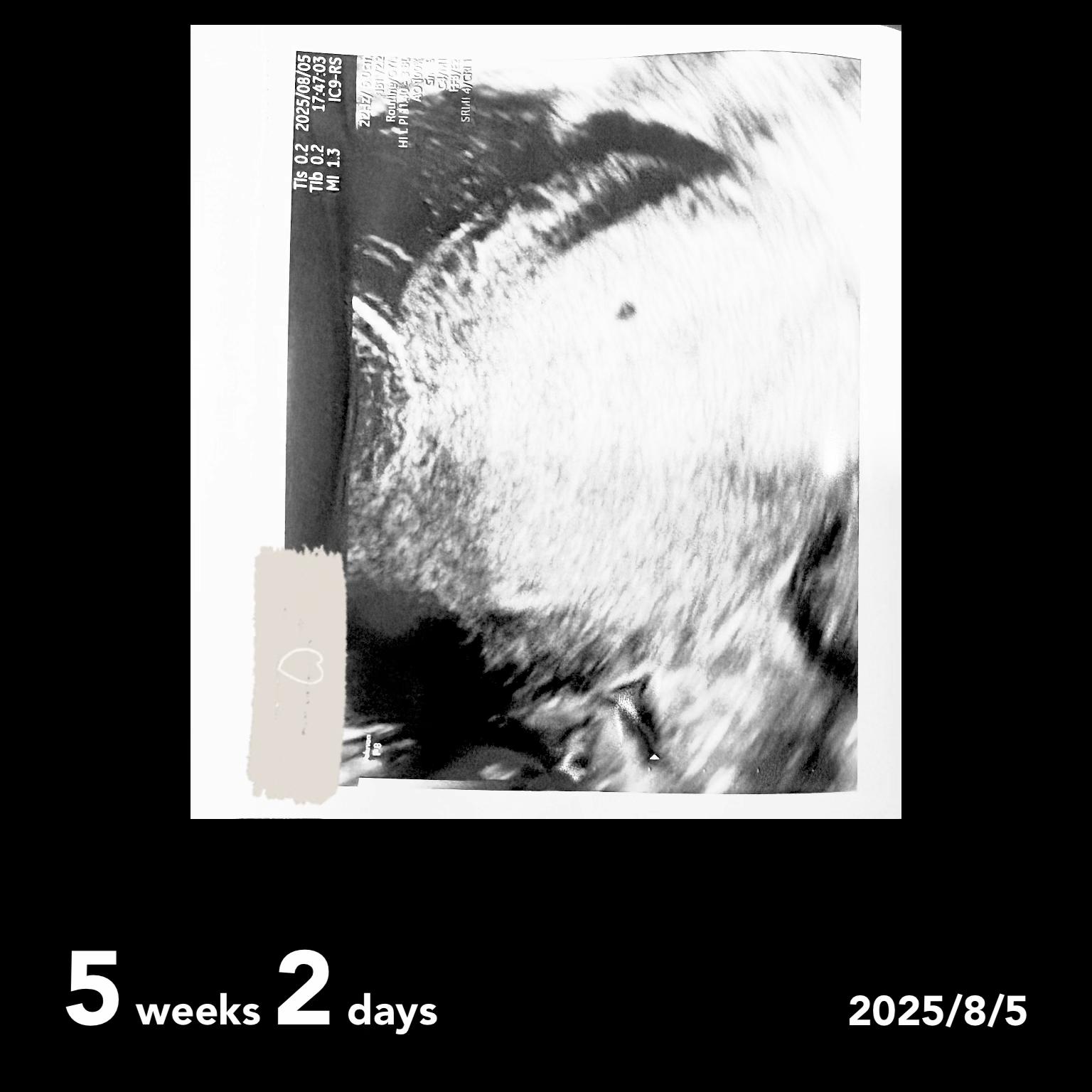 @Baby/WAð¶ð»ðŒ