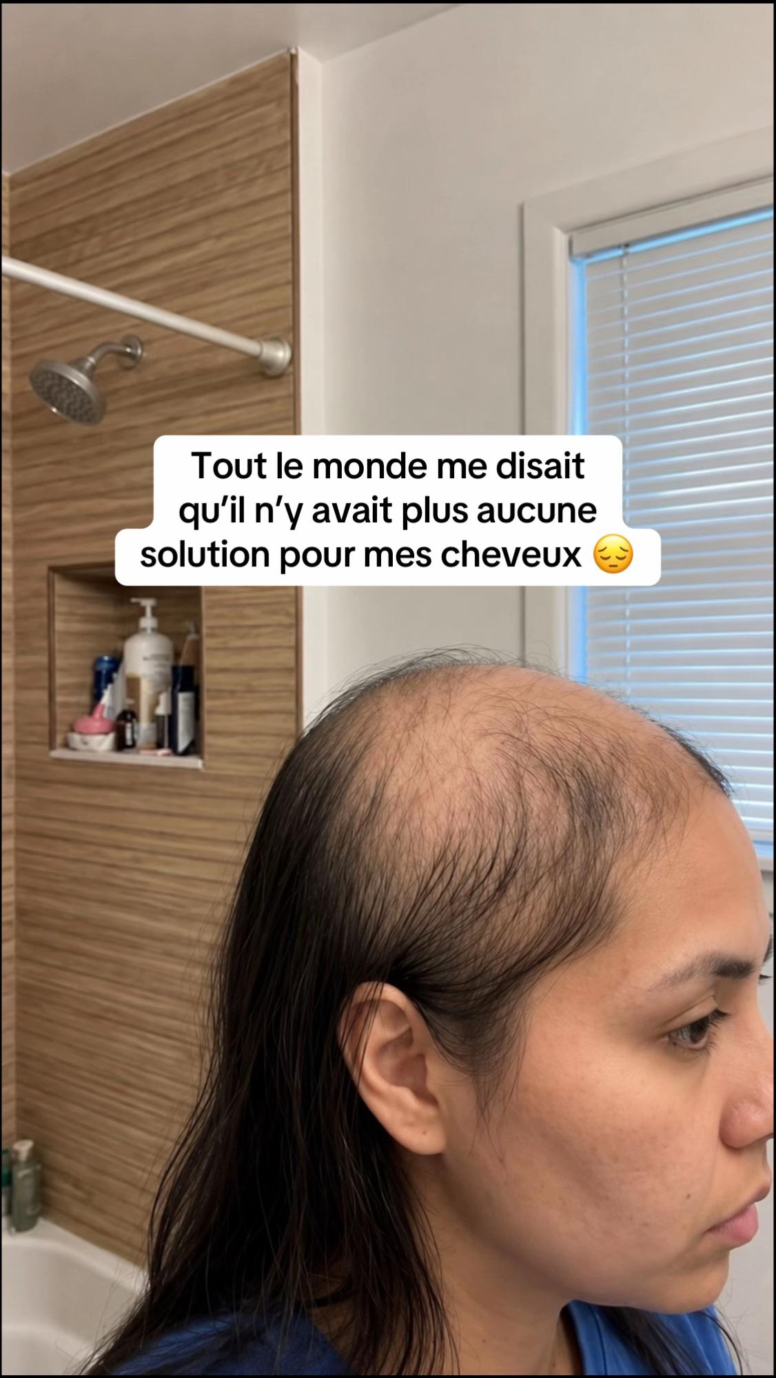 @Lux&rsquo;Hair Growth