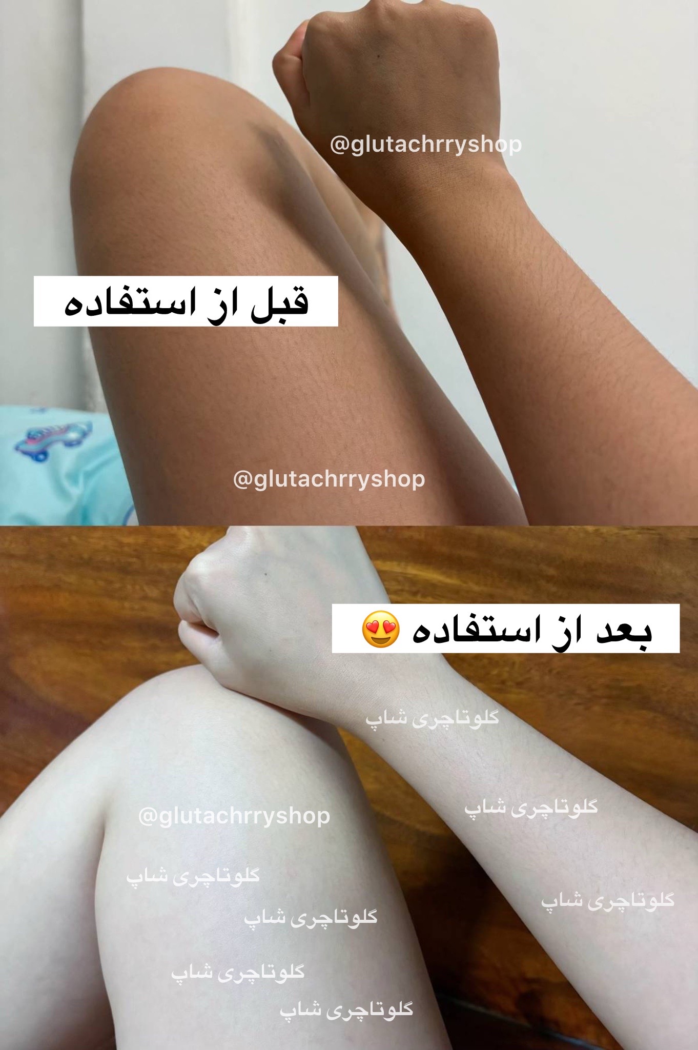 @گلوتاچری شاپ