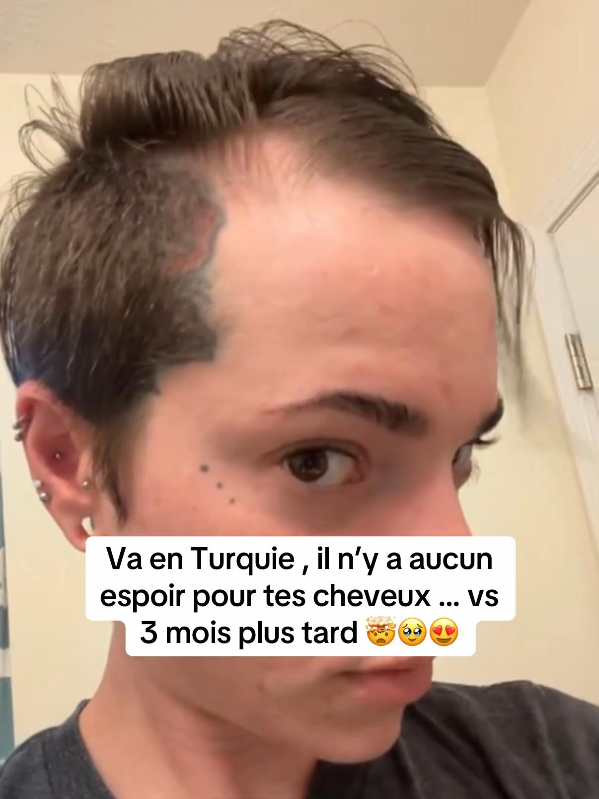 @Lux’Hair Growth