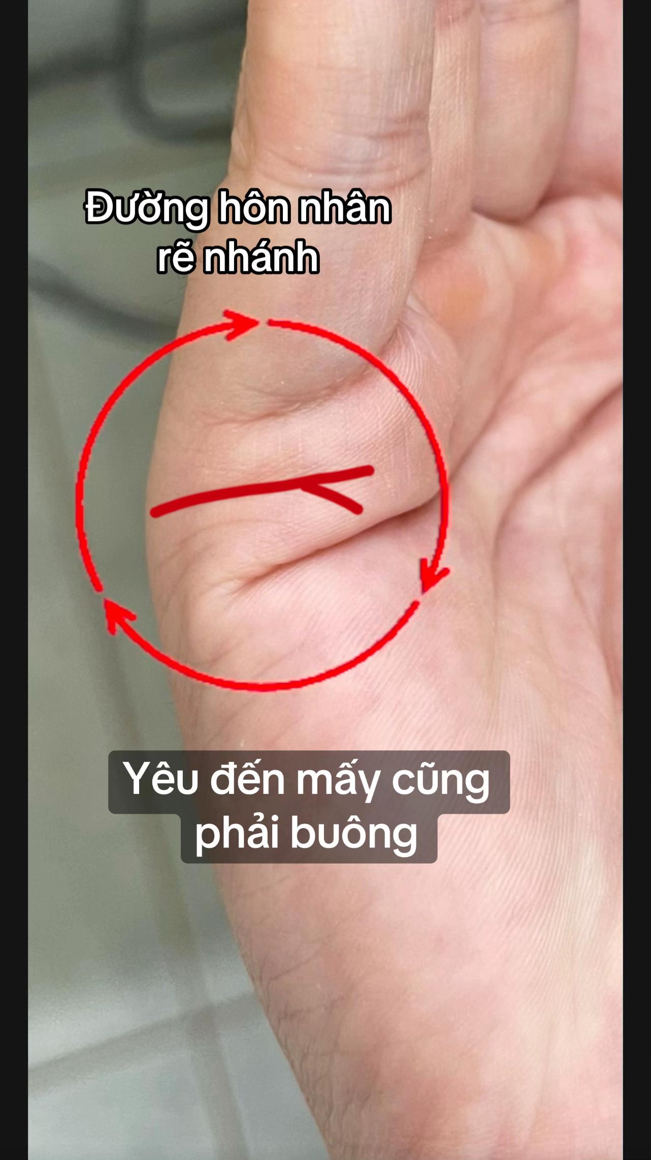 @VẬN MỆNH RADIO