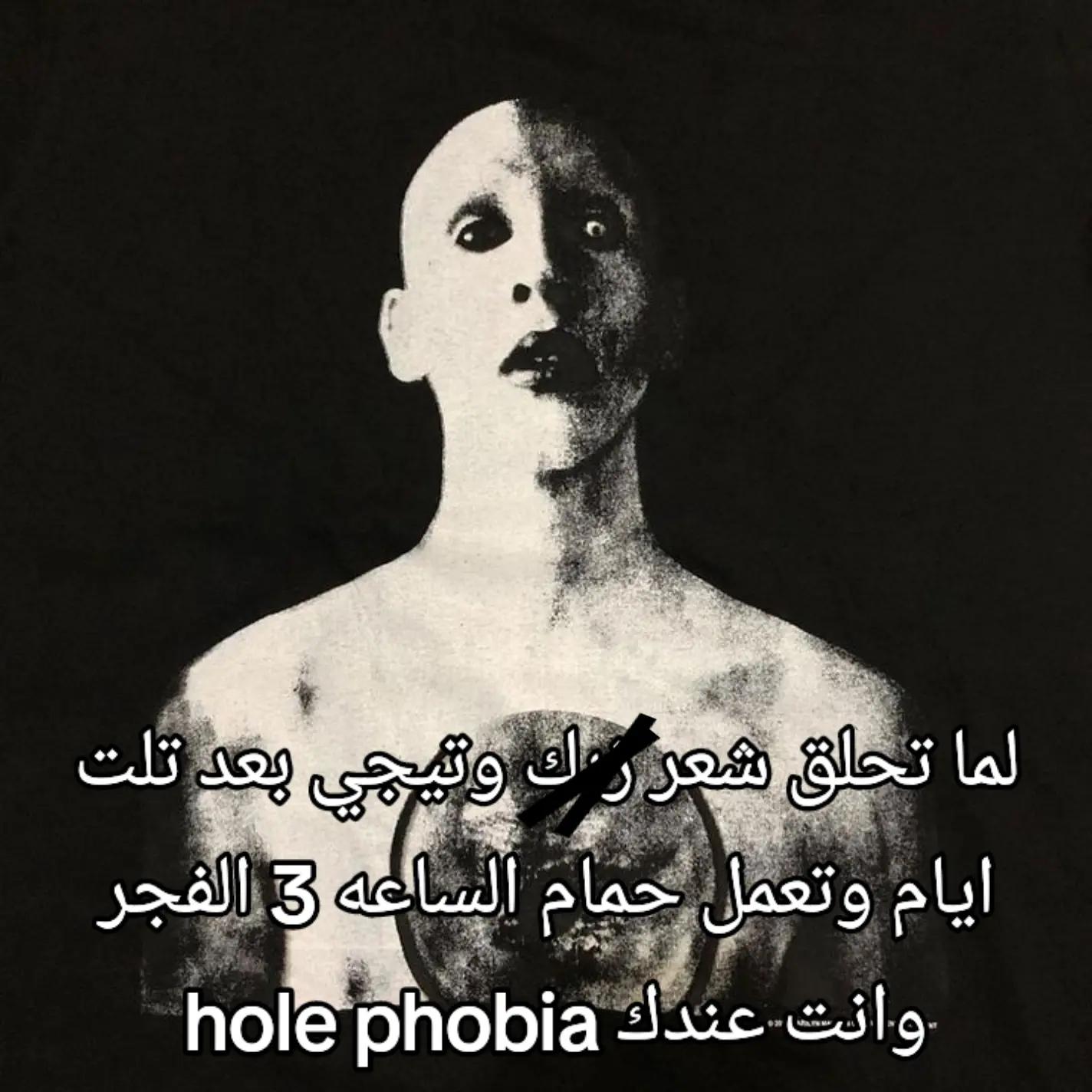 @شوكه مطبخ