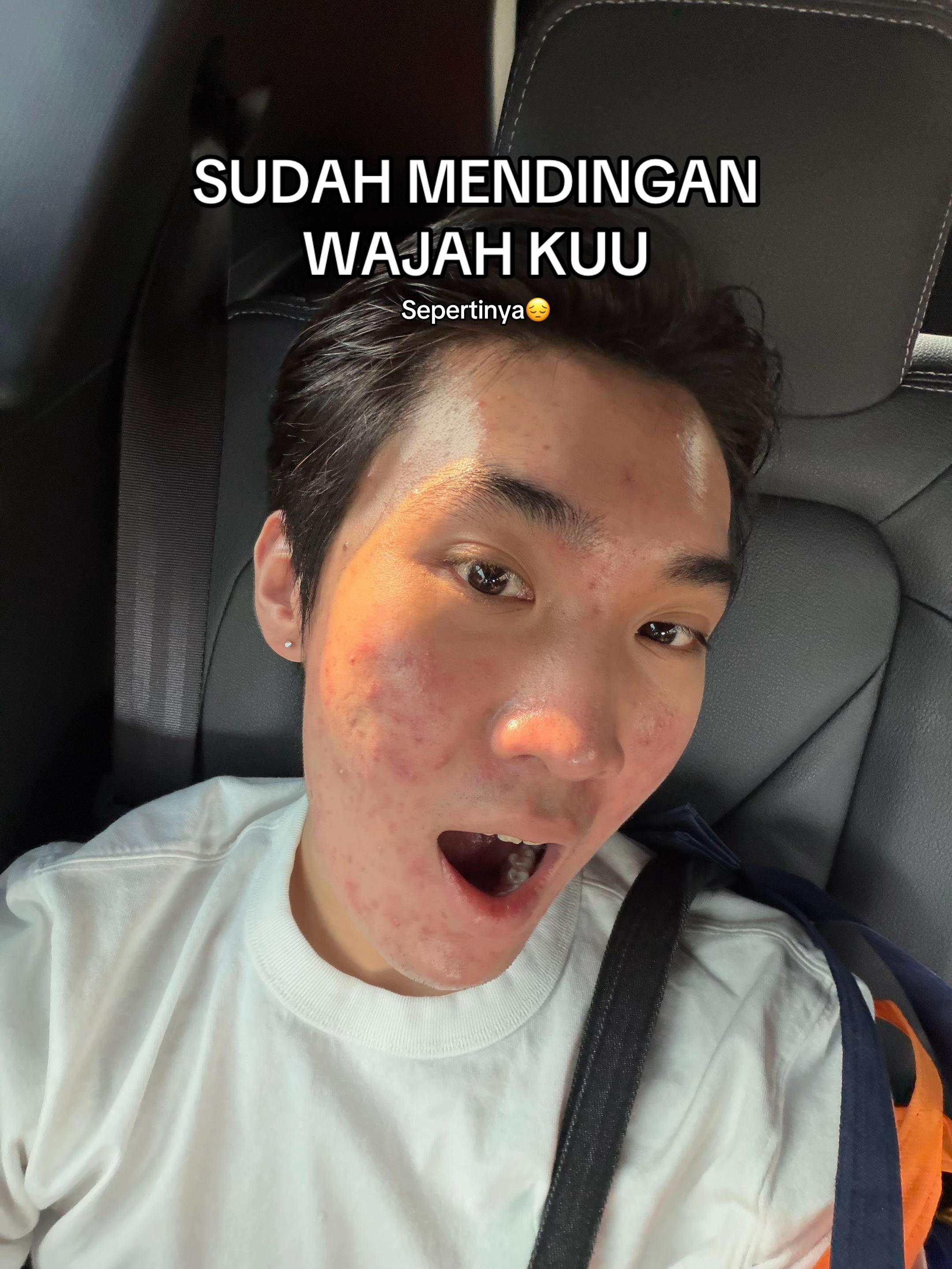 @Mau kulit sehat