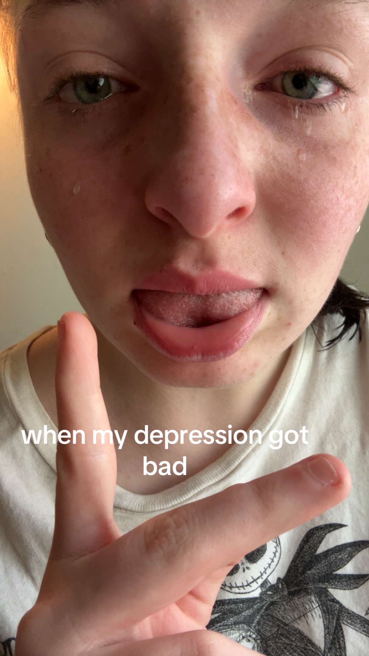 @😵💫🫰