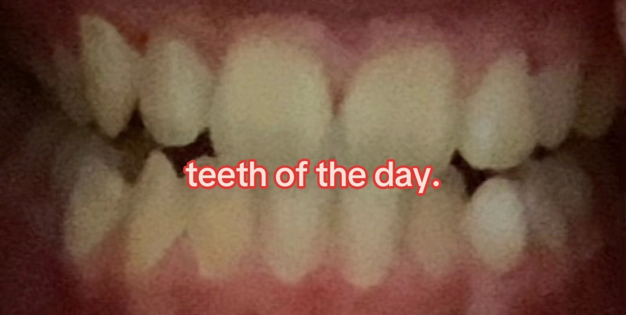 @I leik teeth moer thna mysefl.