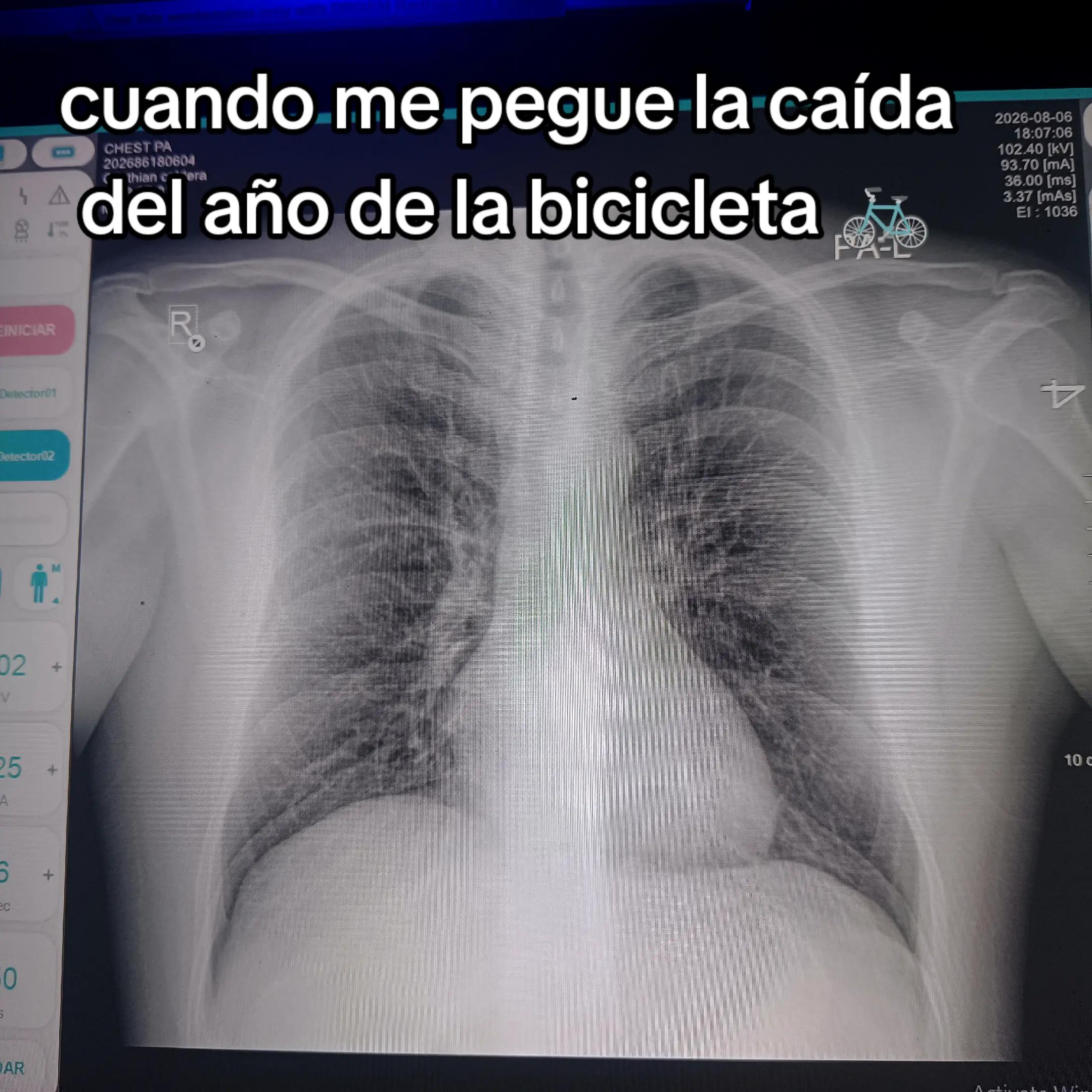 @Chris caldera
