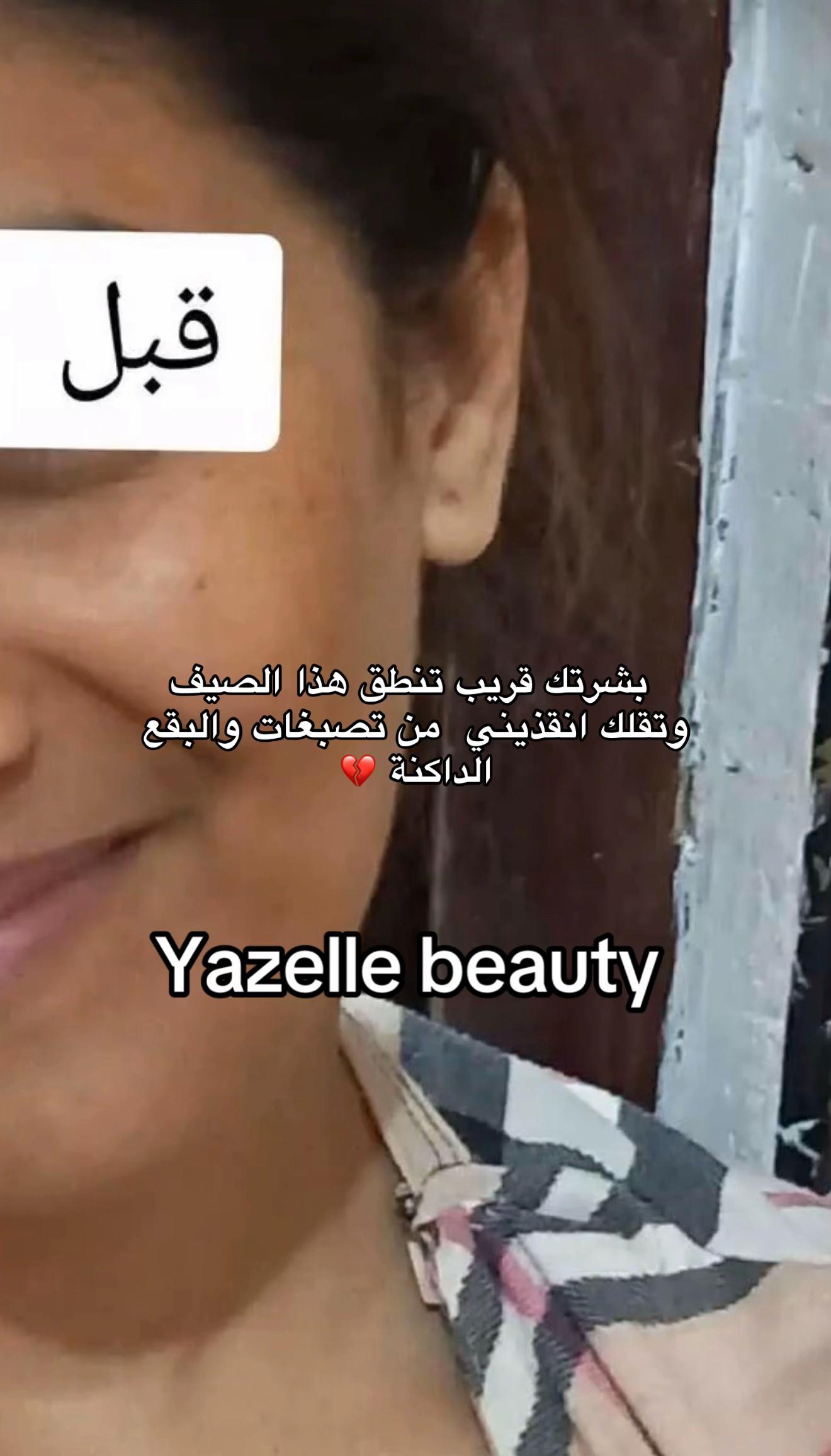 @جمالك وأنوثتك مع يزال🎀