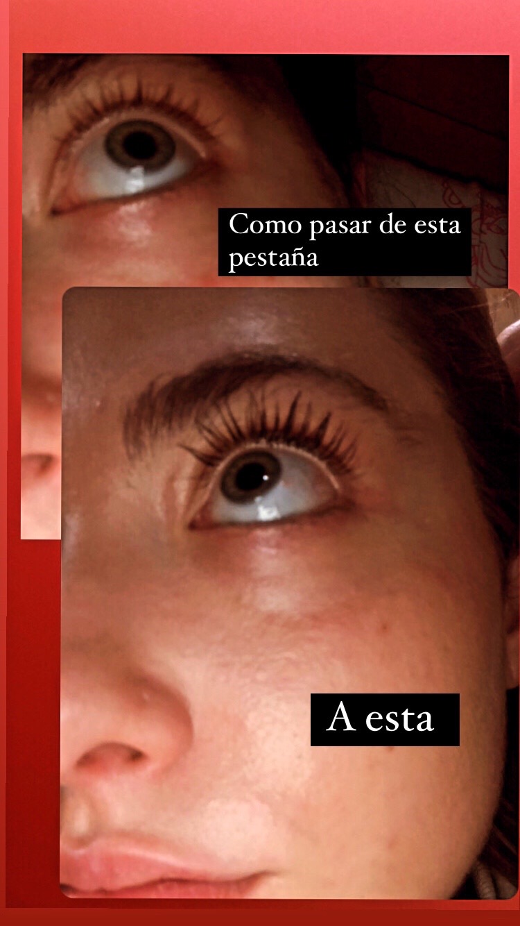 @alaznesaanz