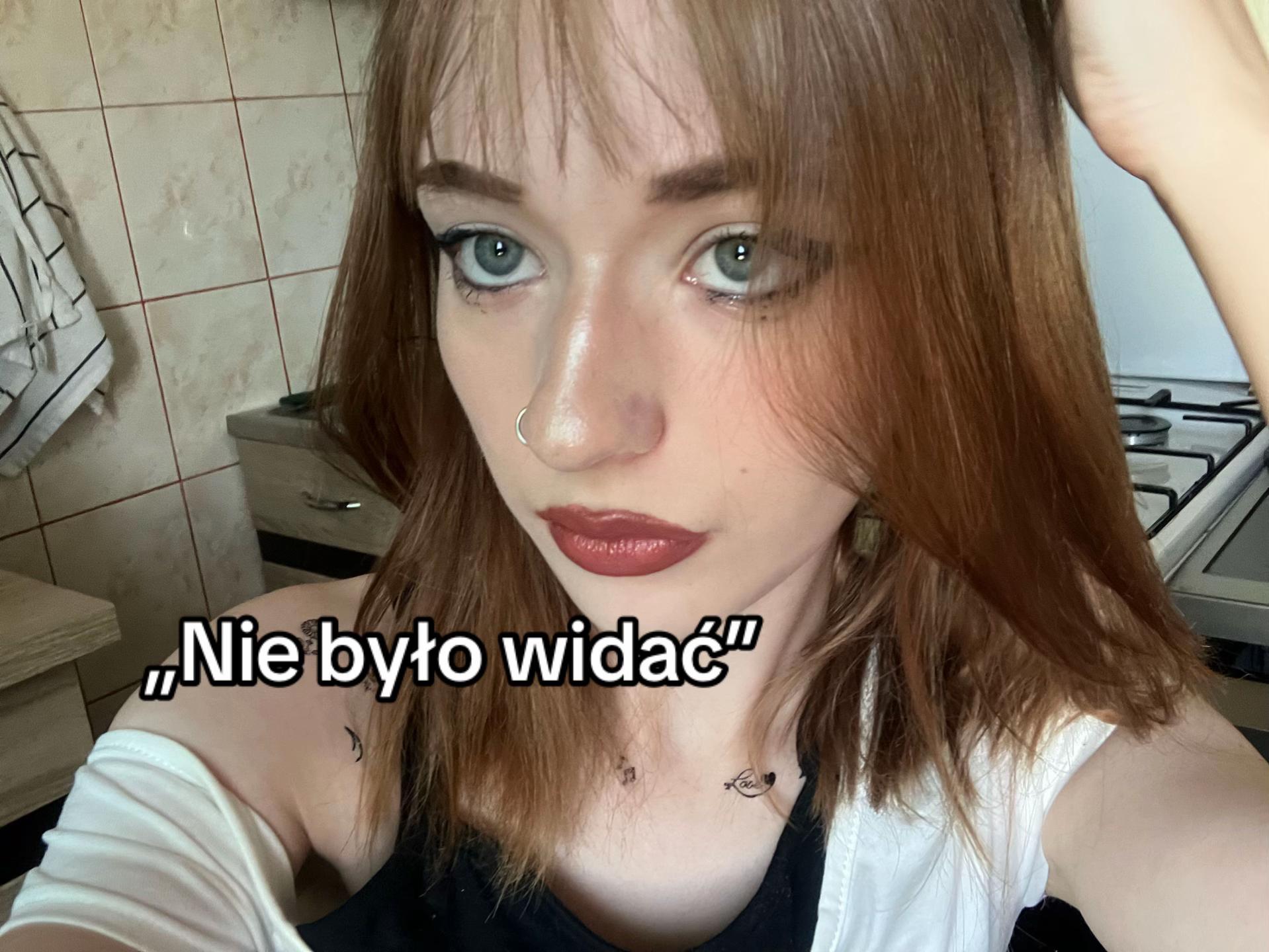 @Sonja