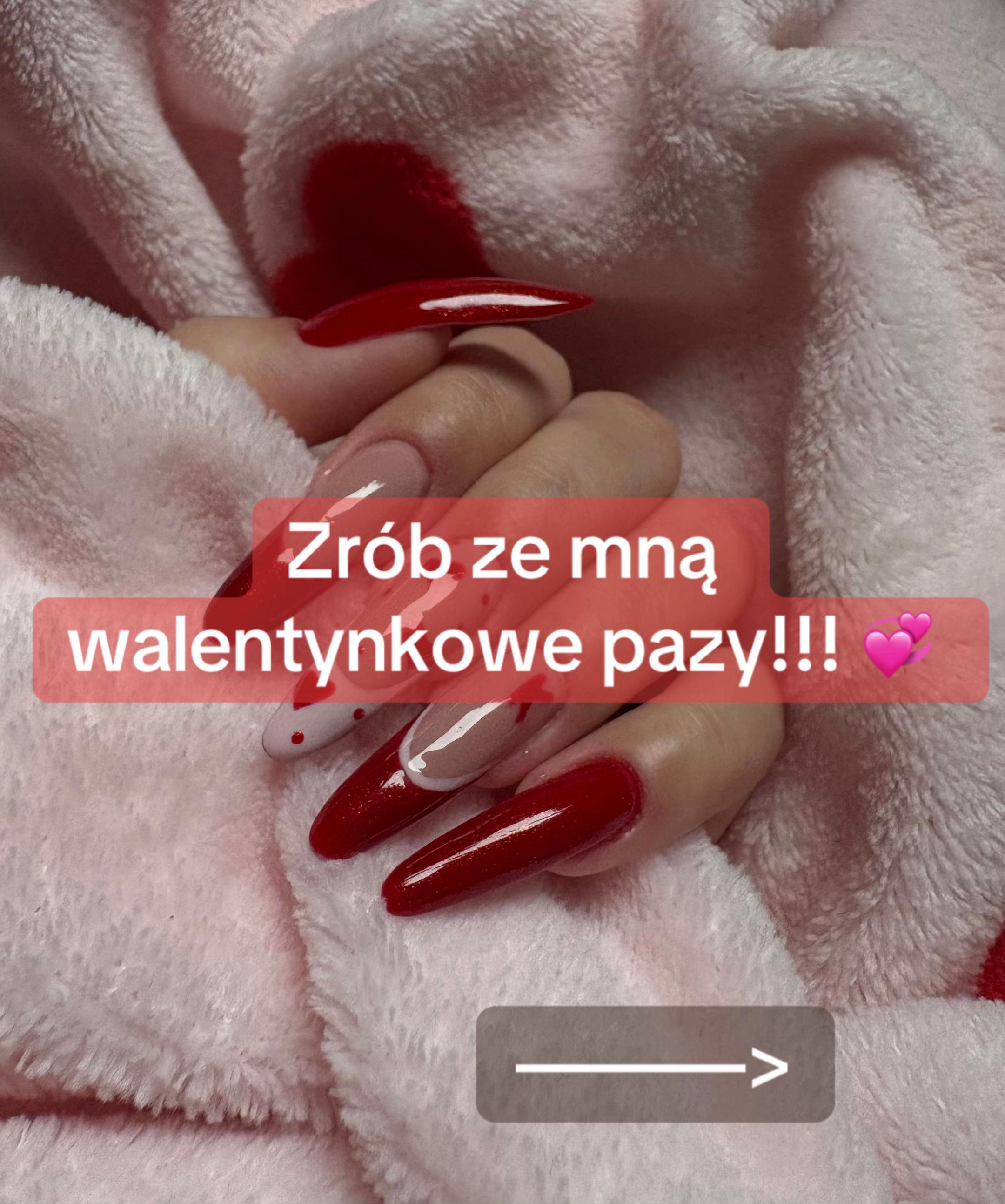 @zhzia | Ig : miszuzi_
