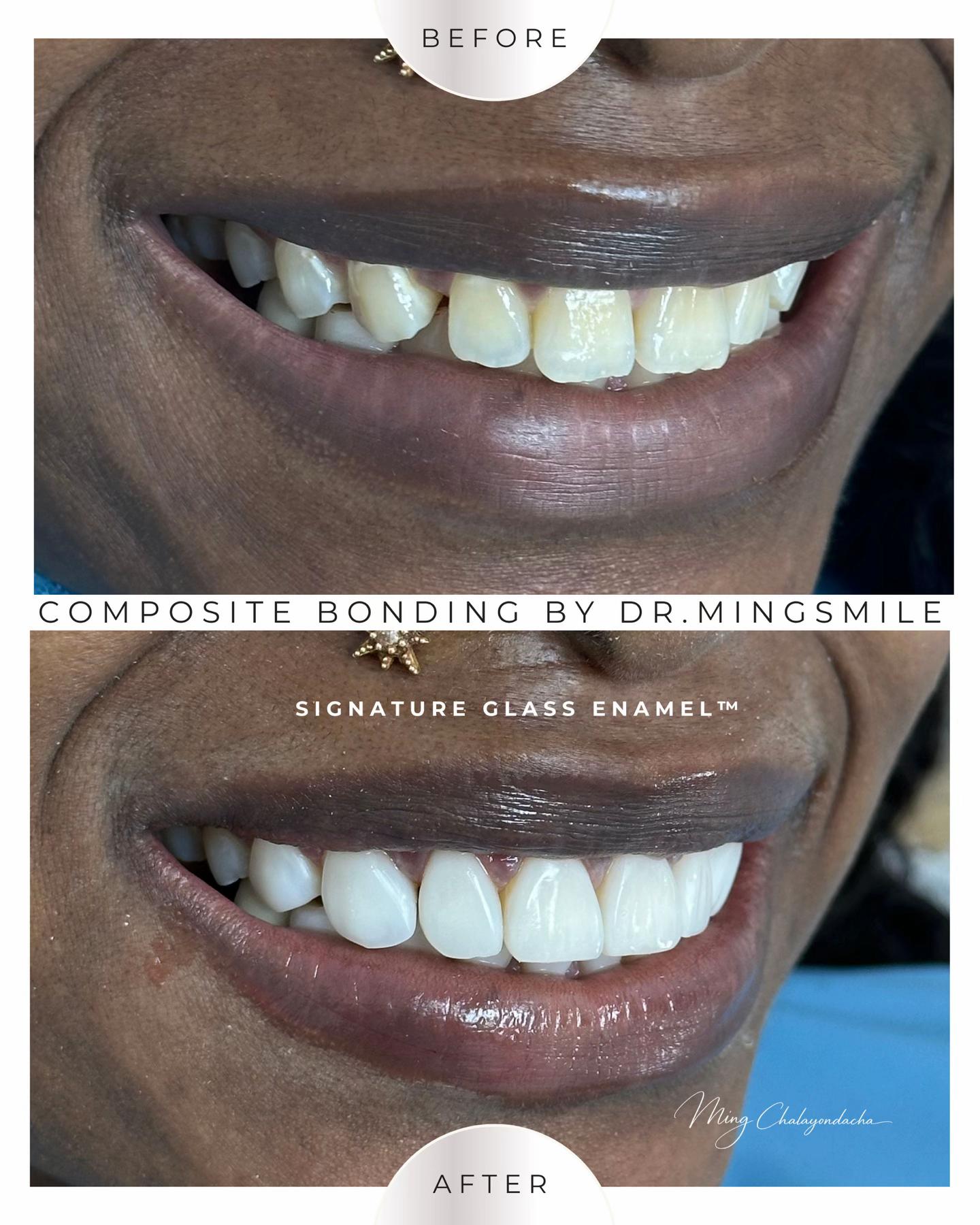 @Dr.MingSmile ♥๏ธ Bangkok&Krabi