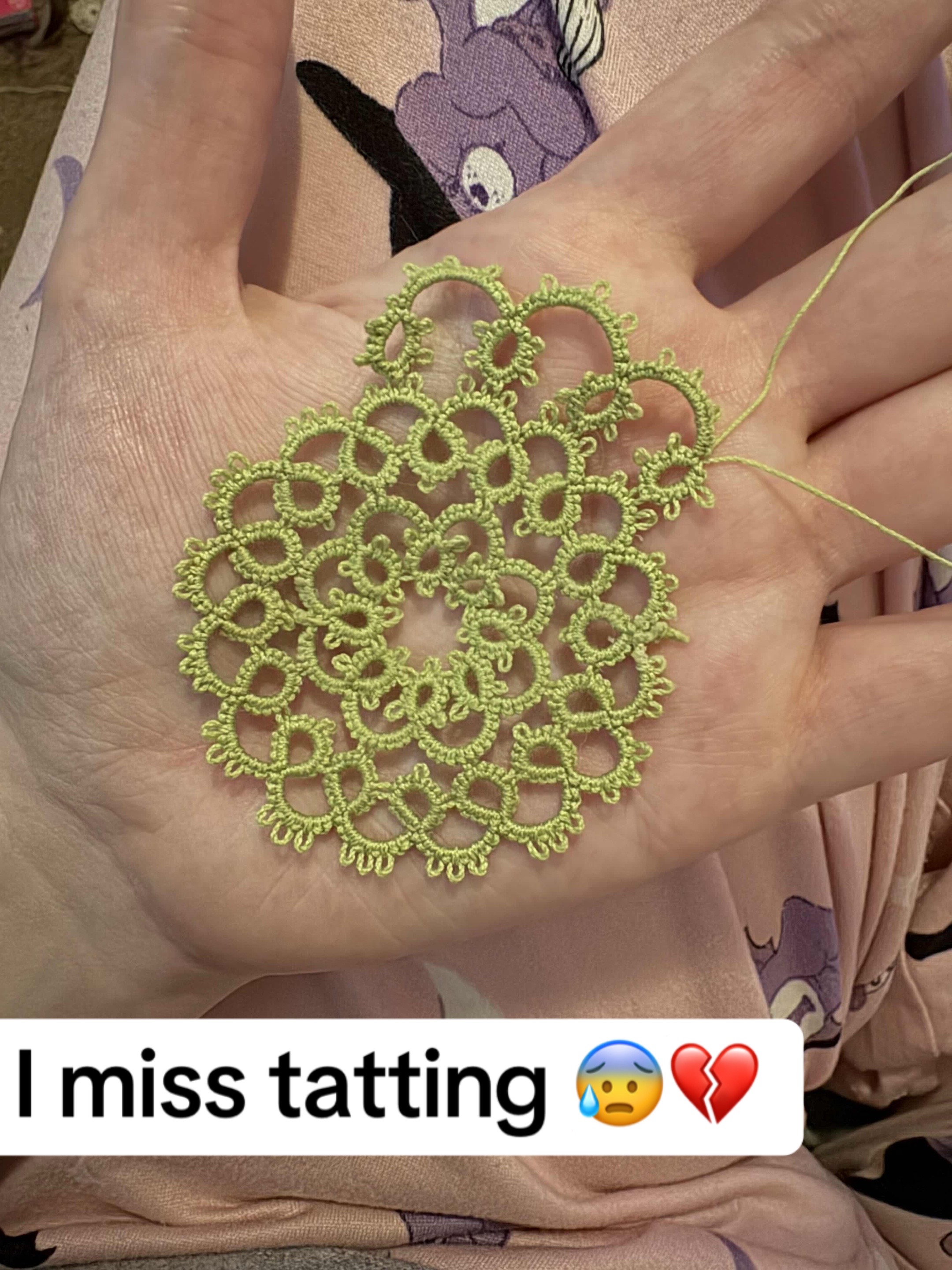 @Angie 🌦️