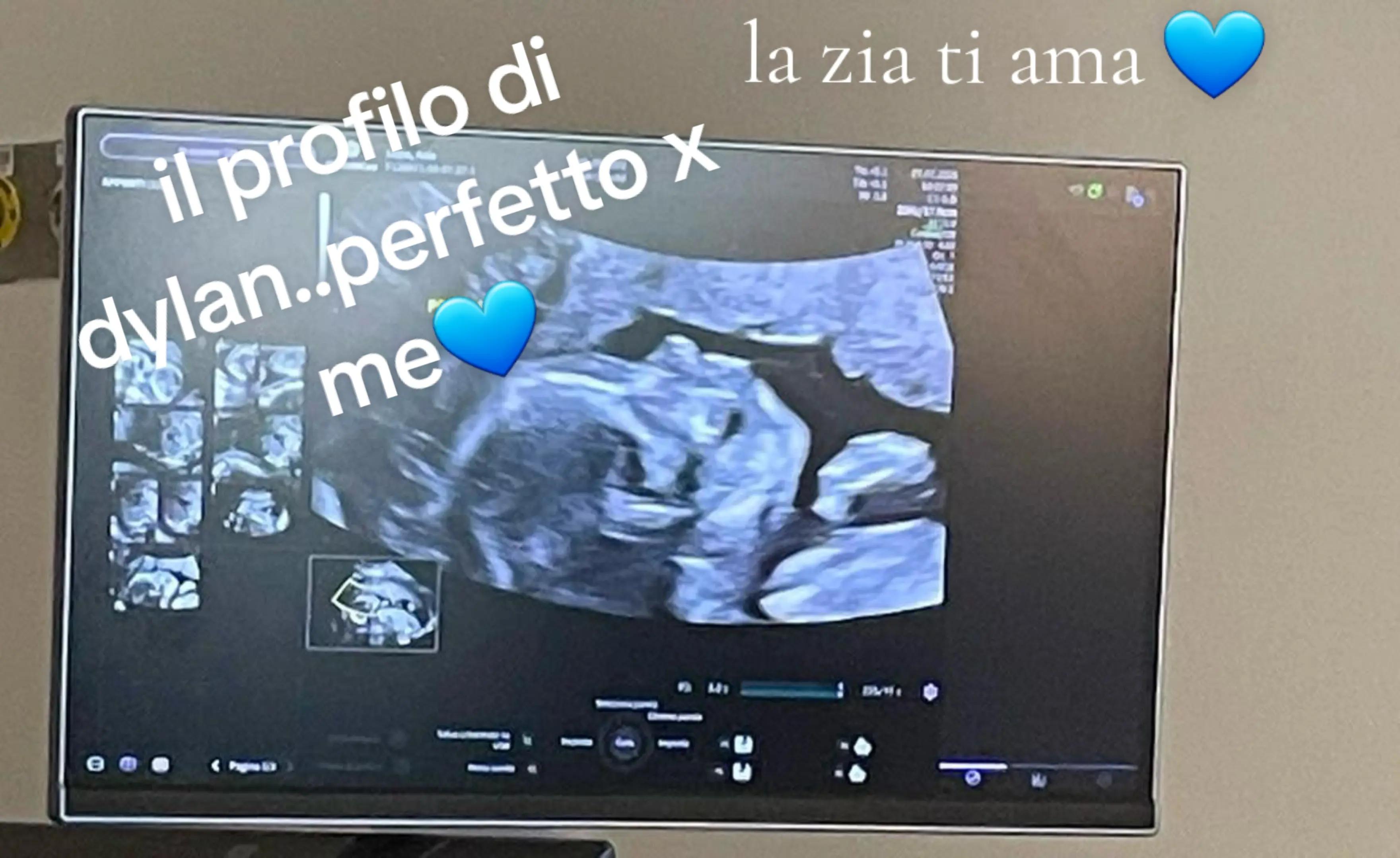 @Luisa 82