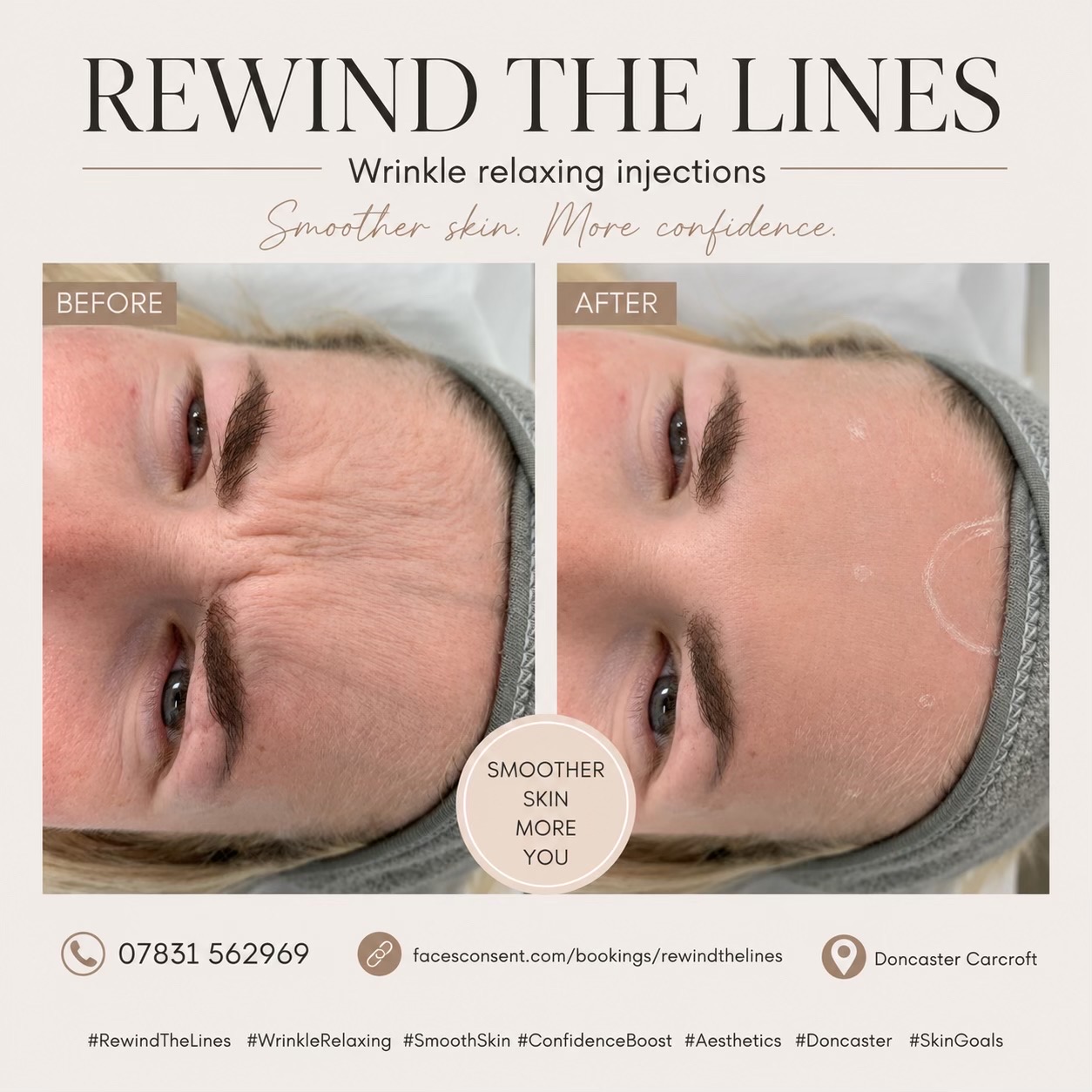 @Rewind the lines