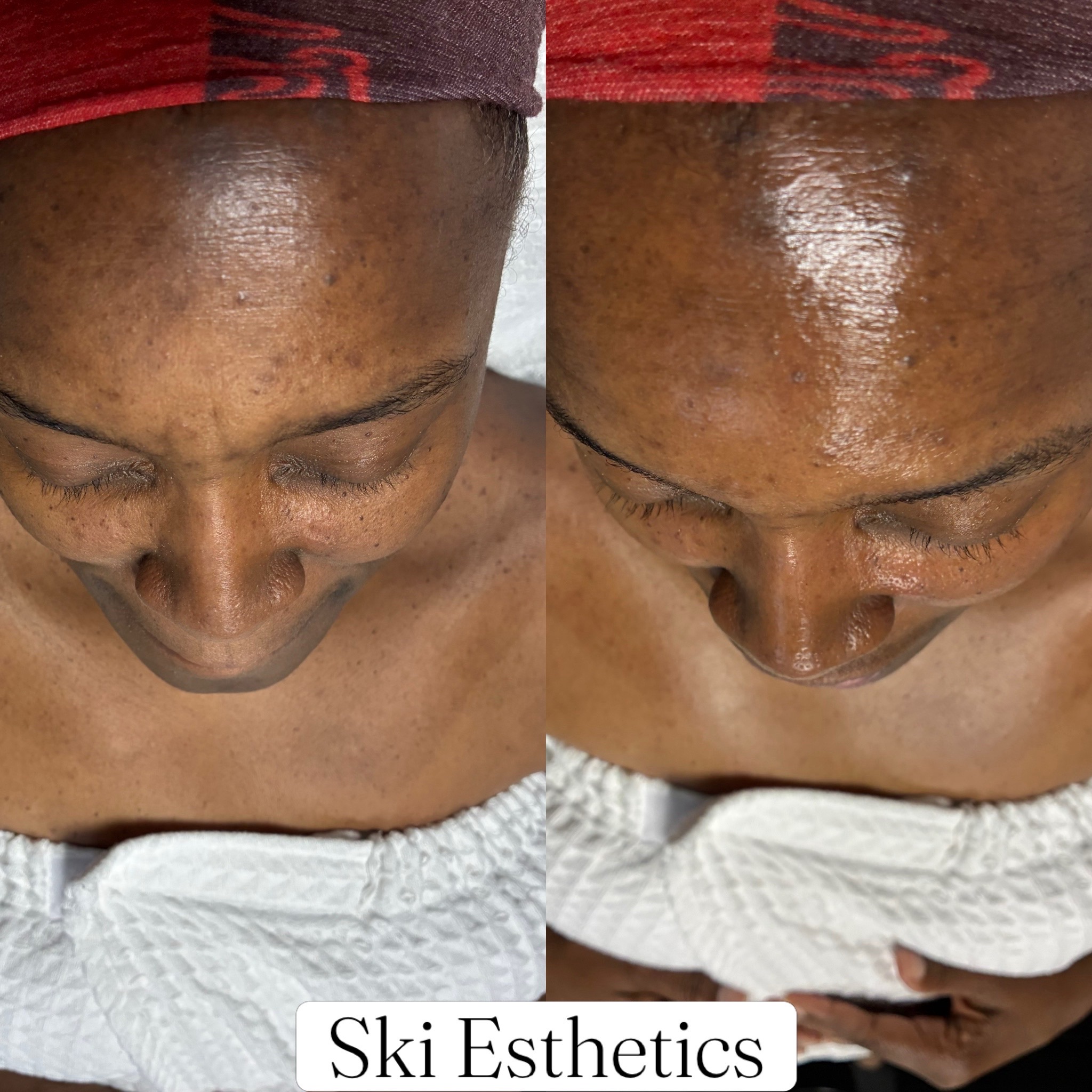@skiesthetics