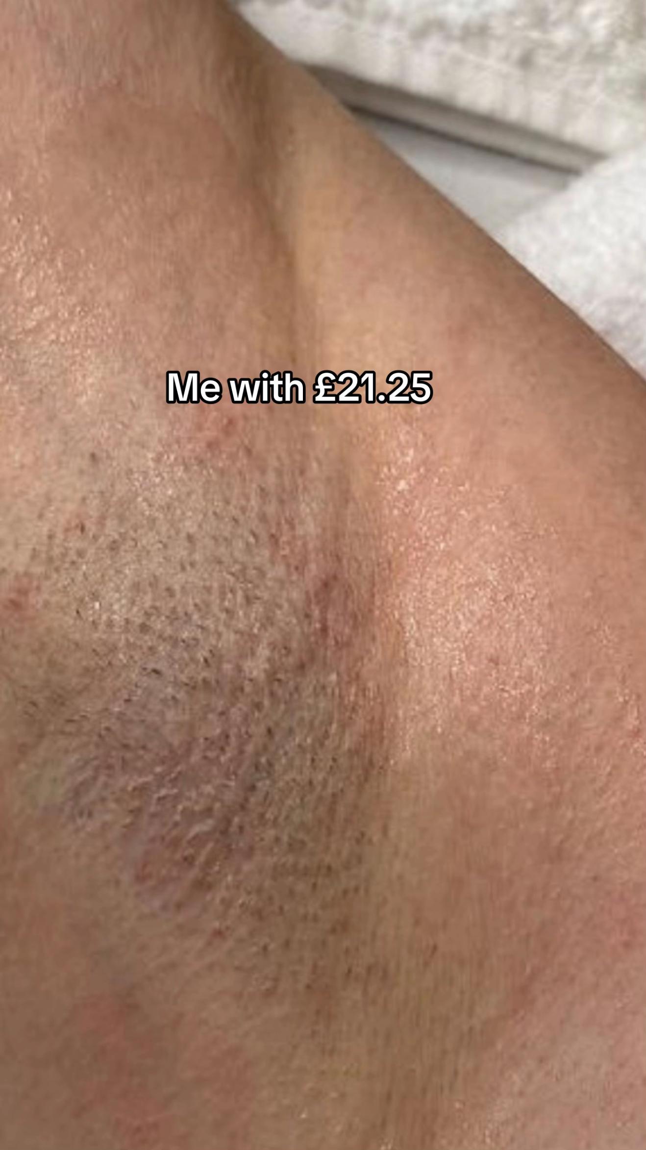 @London Laser and aesthetics