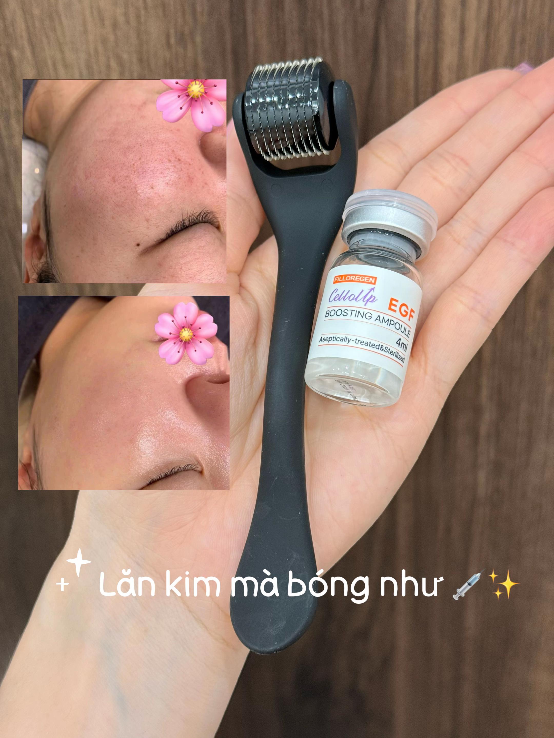 @Hồng Nhung nun