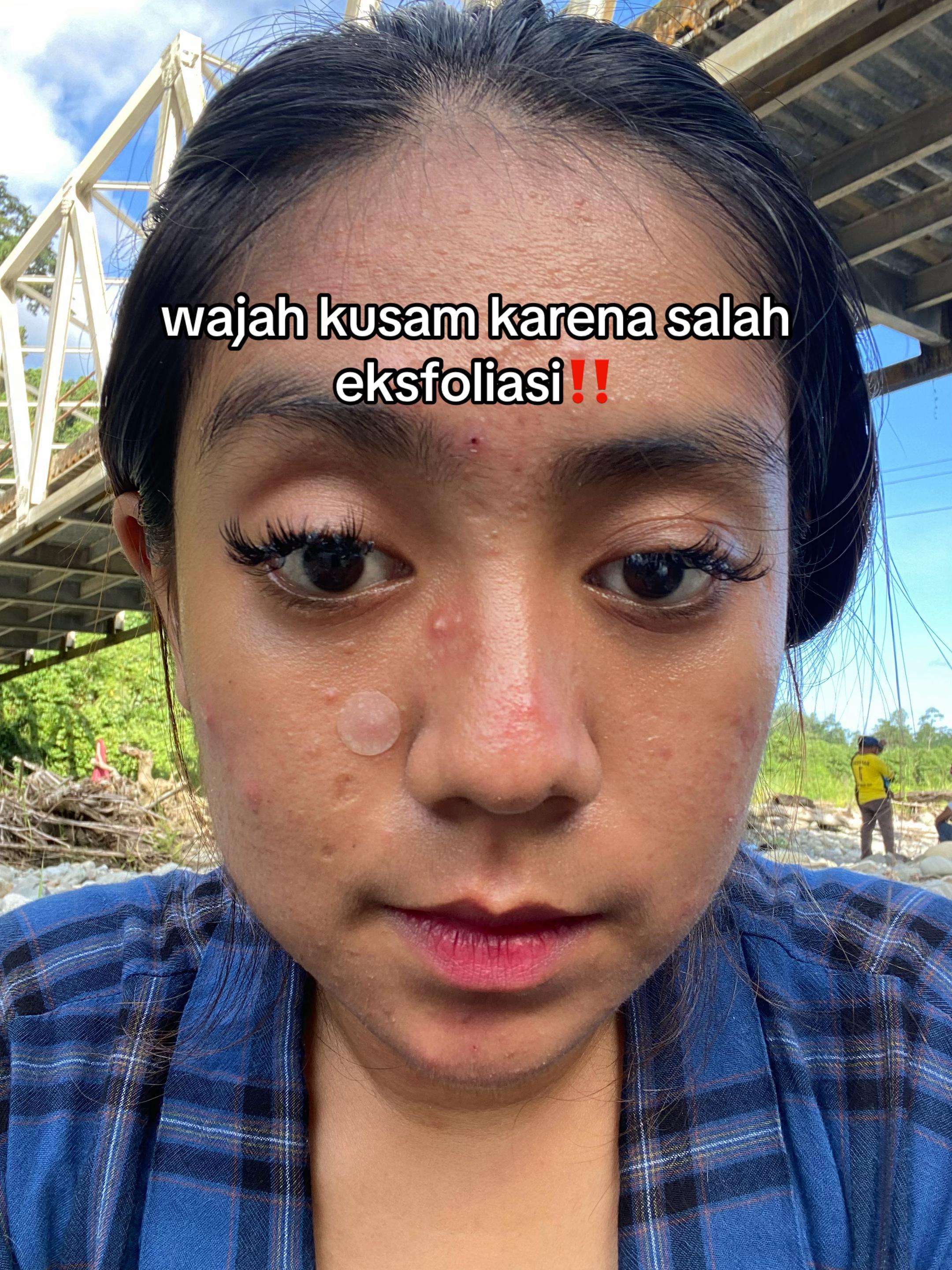 @with love, acha.