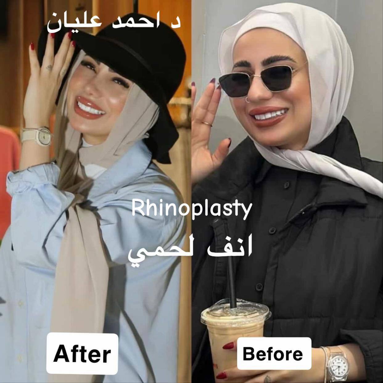 @Dr Ahmad Elayian