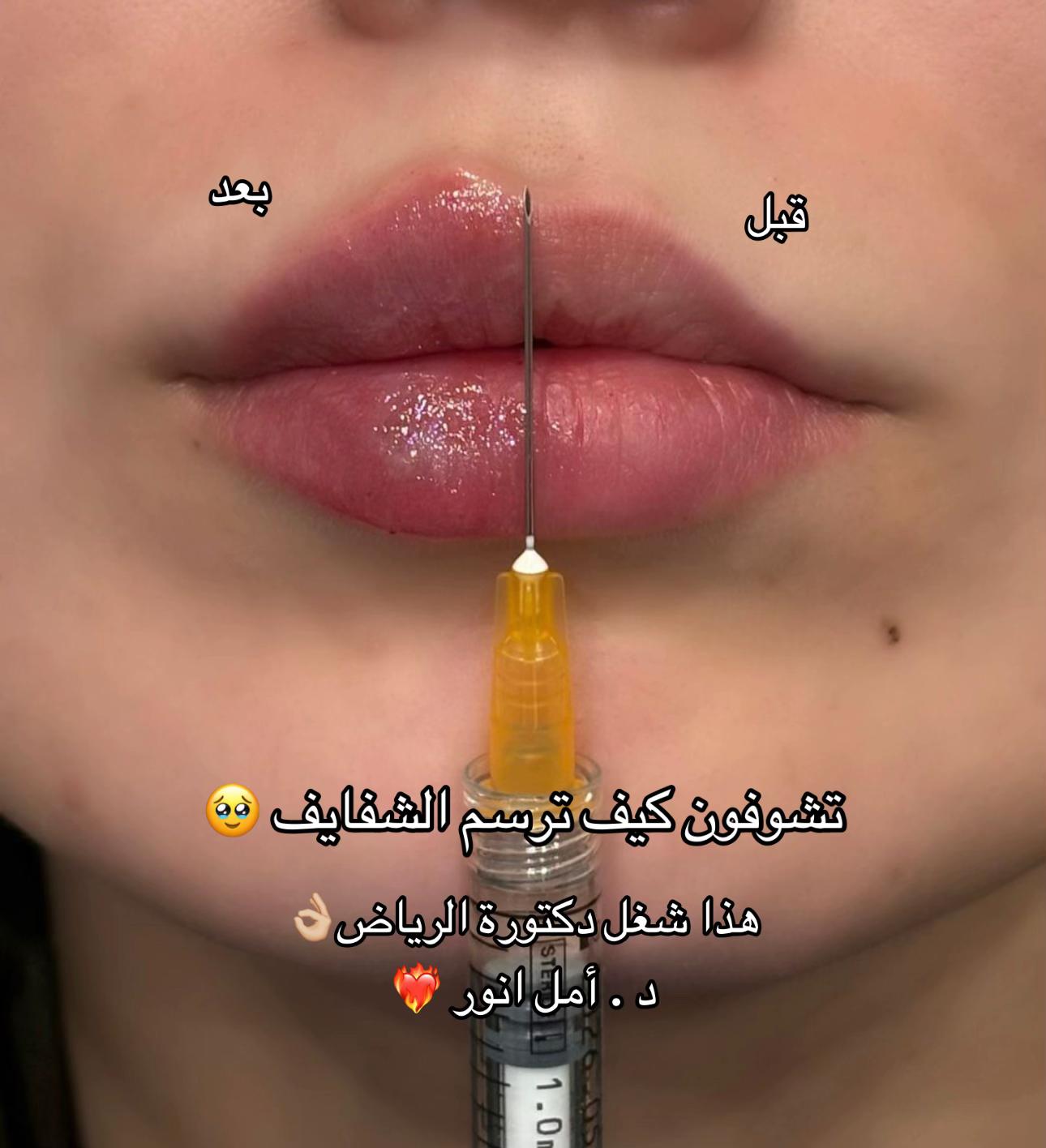 @مركز مزدانه 1 ( فرع الصحافه )