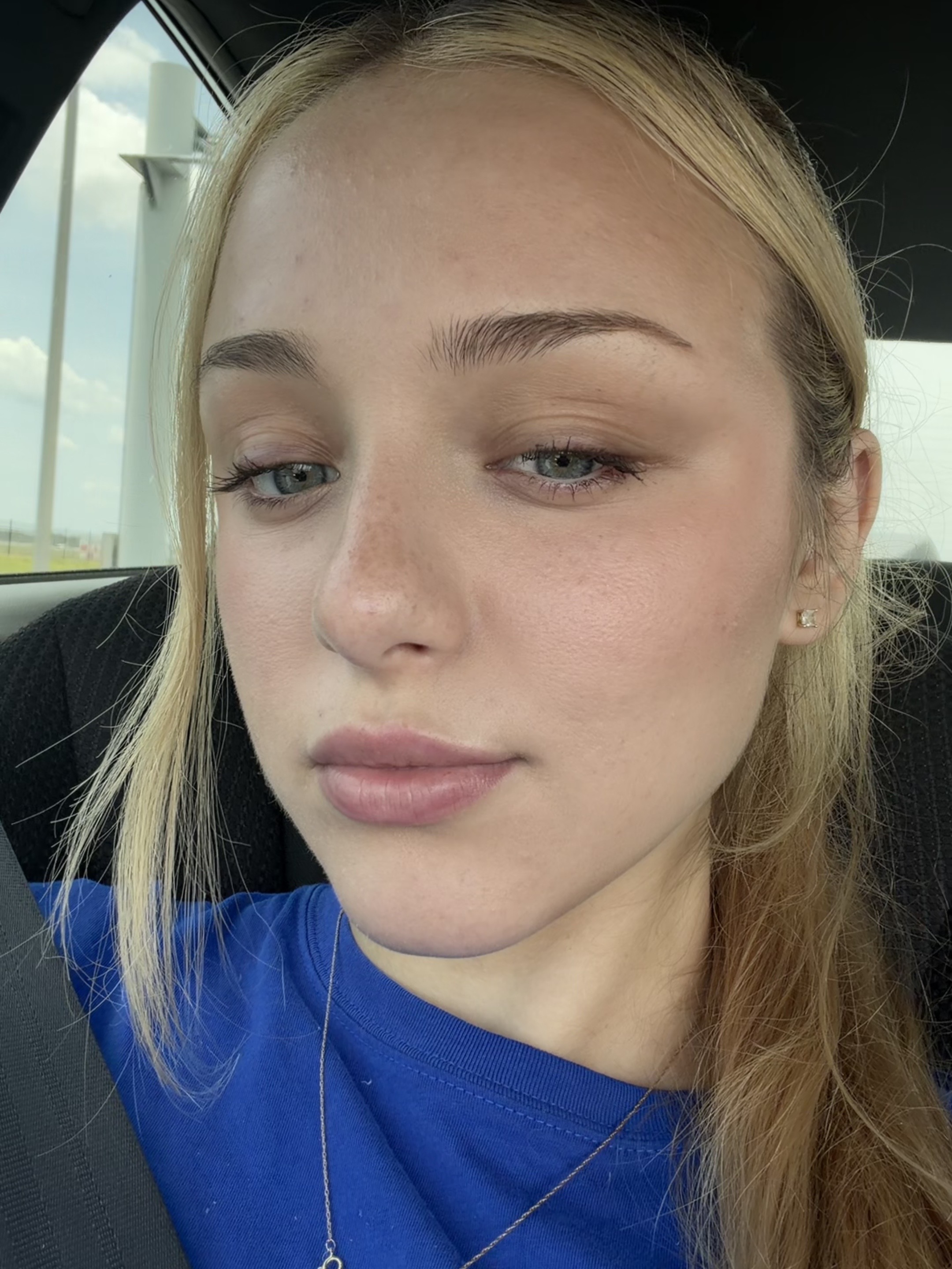 @rach