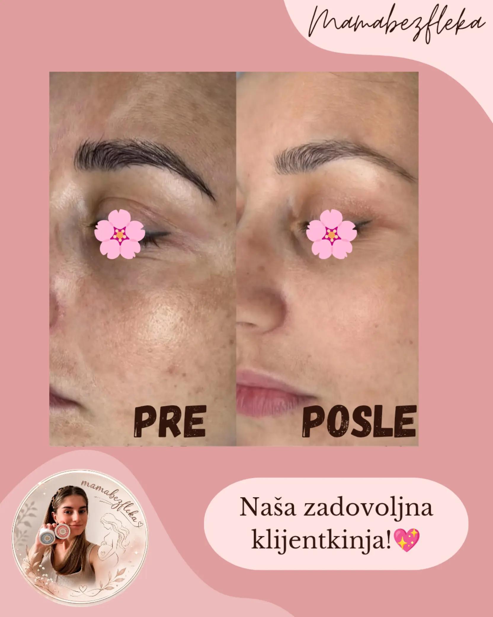 @Mama bez fleka