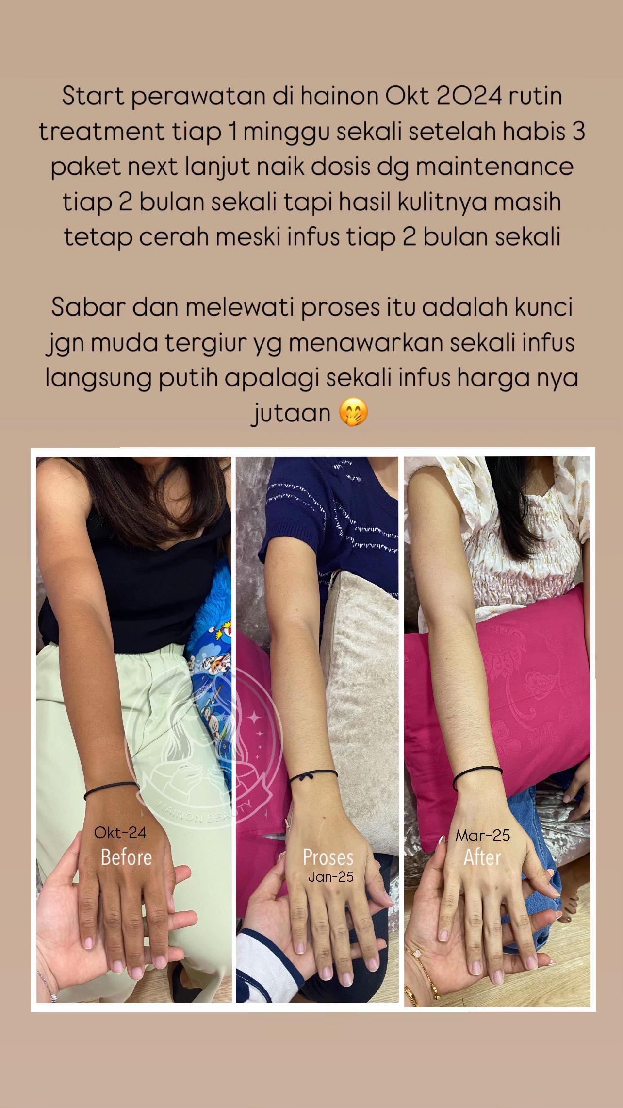 @Hainon Infus Whitening