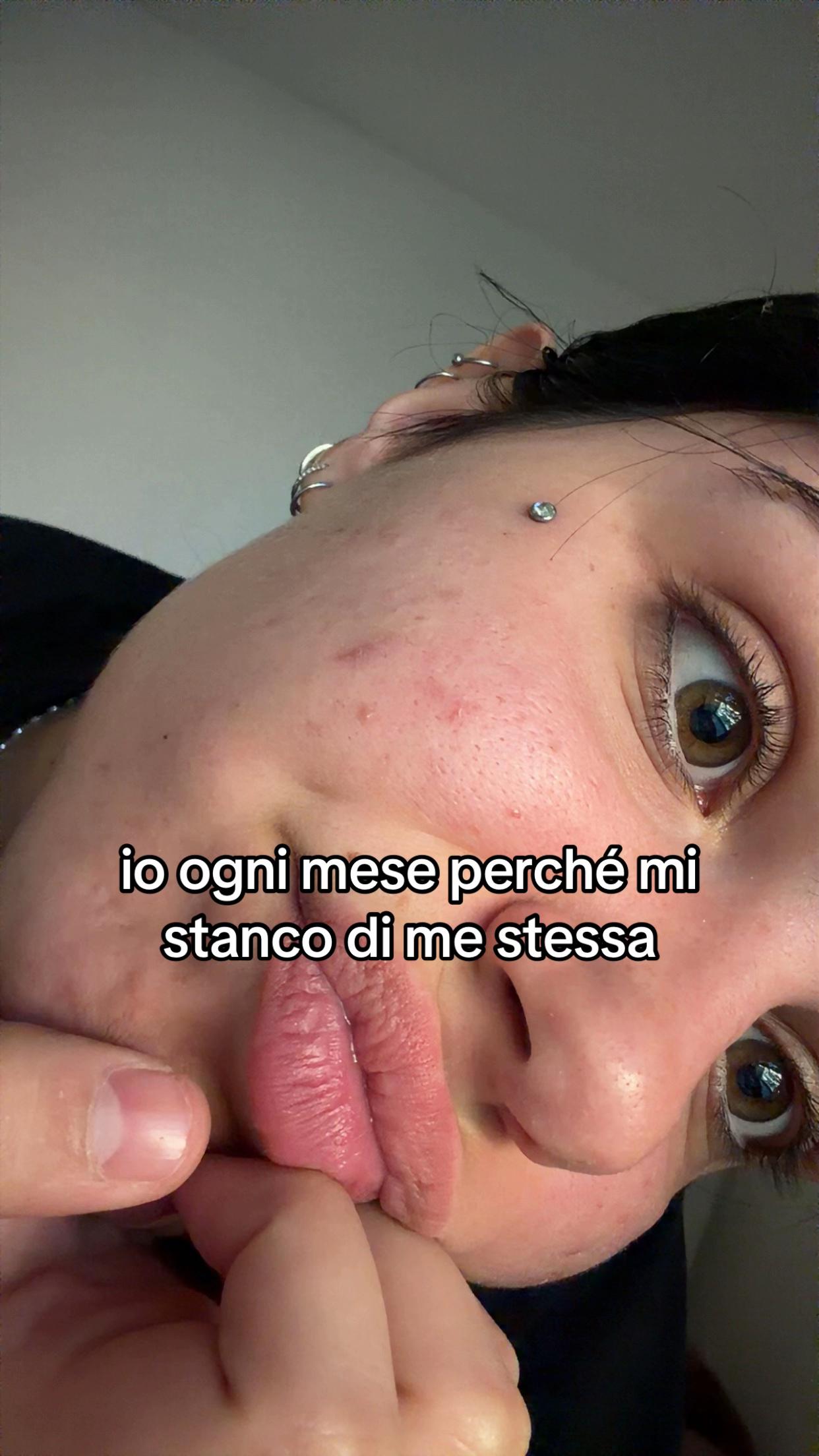 @ale