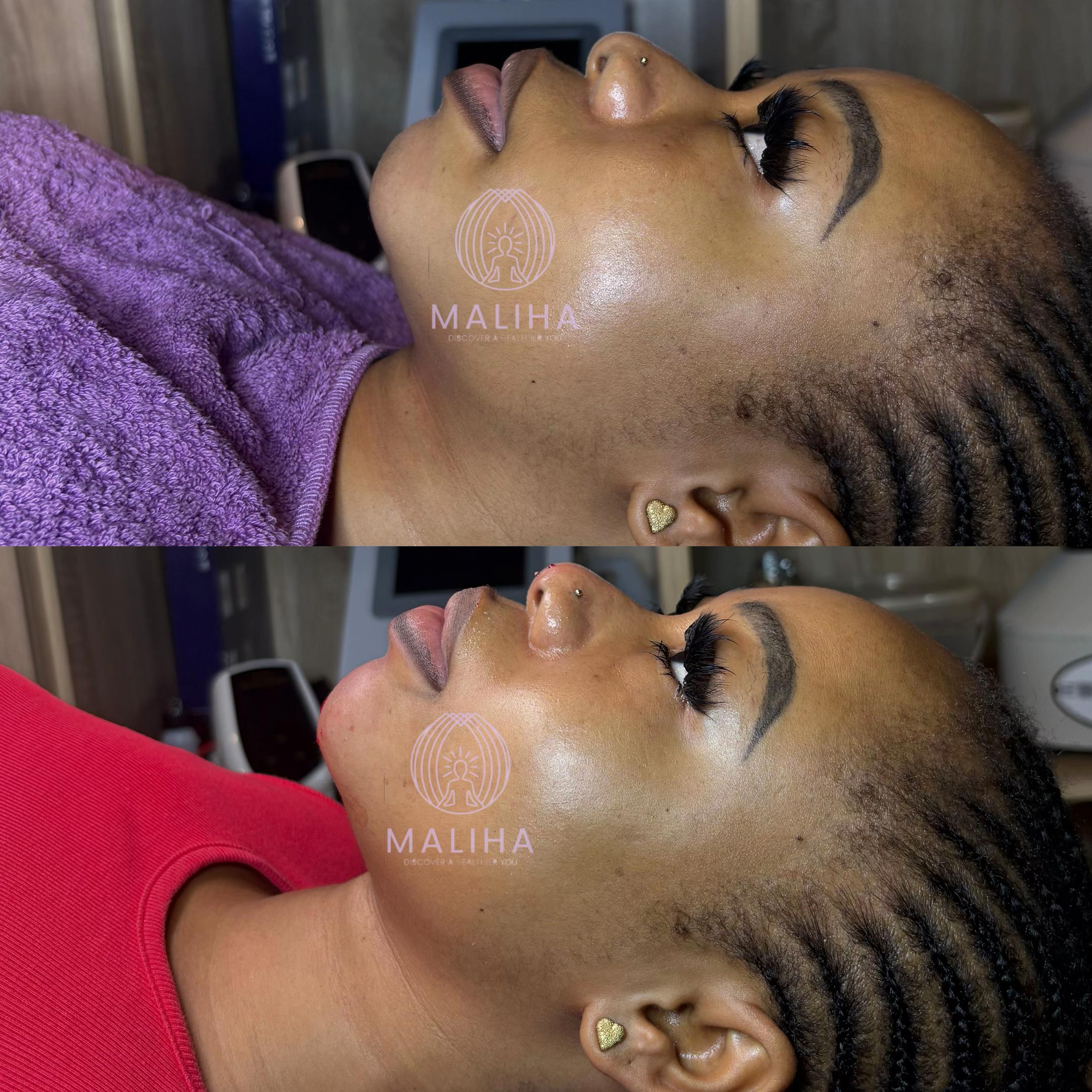 @No1 Med Spa & Saloon In Benin
