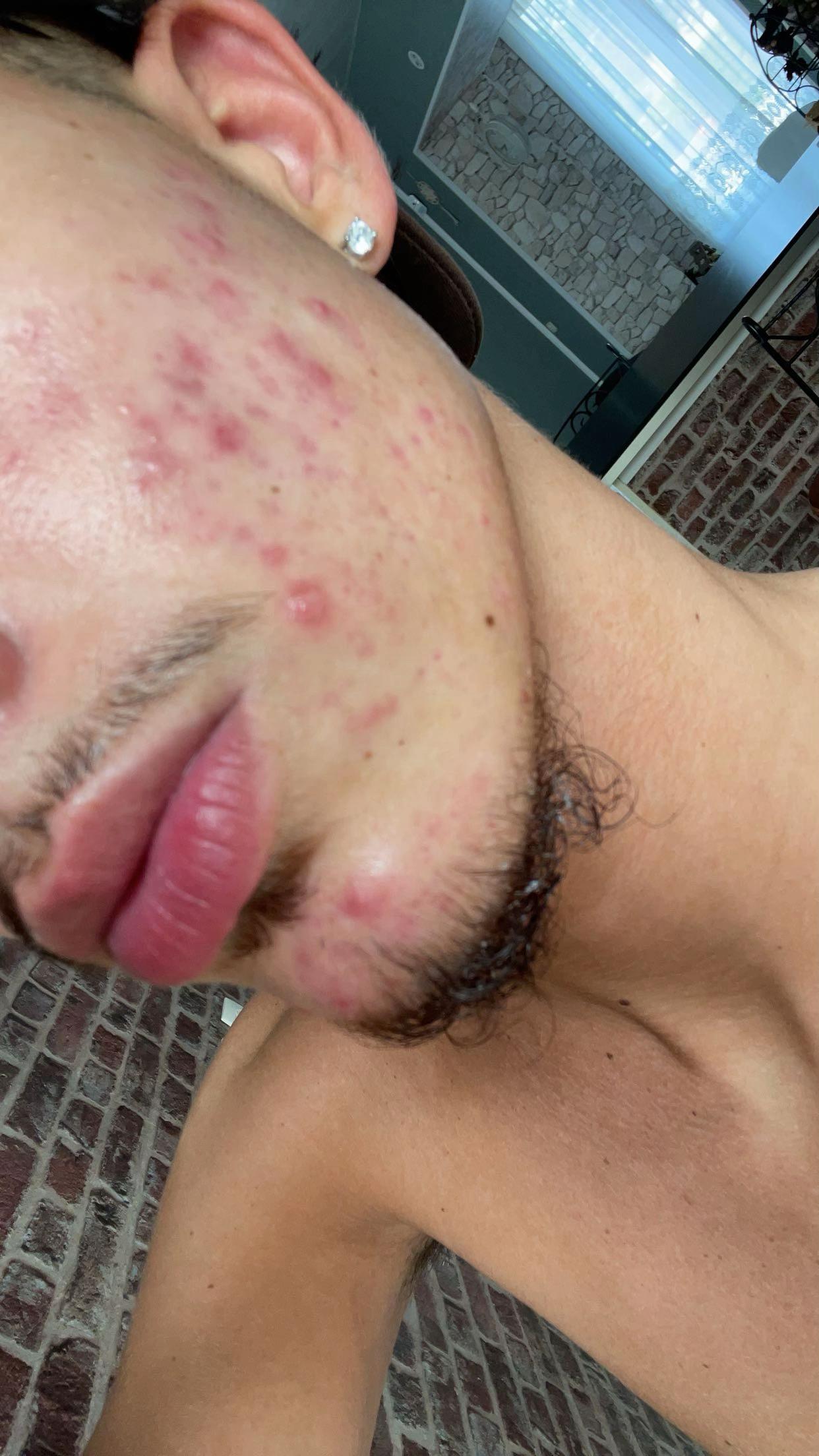 @rico