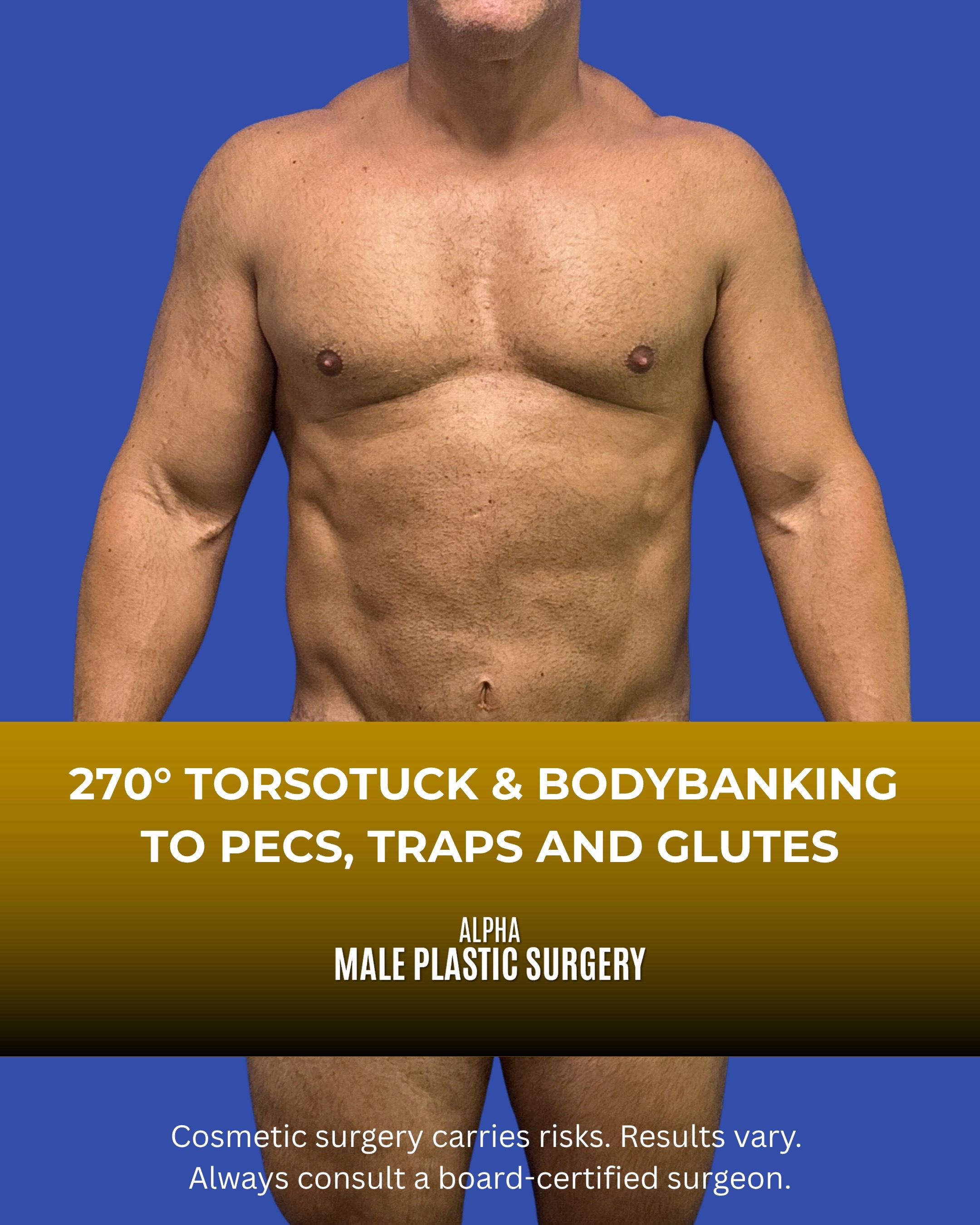 @mensplasticsurgery