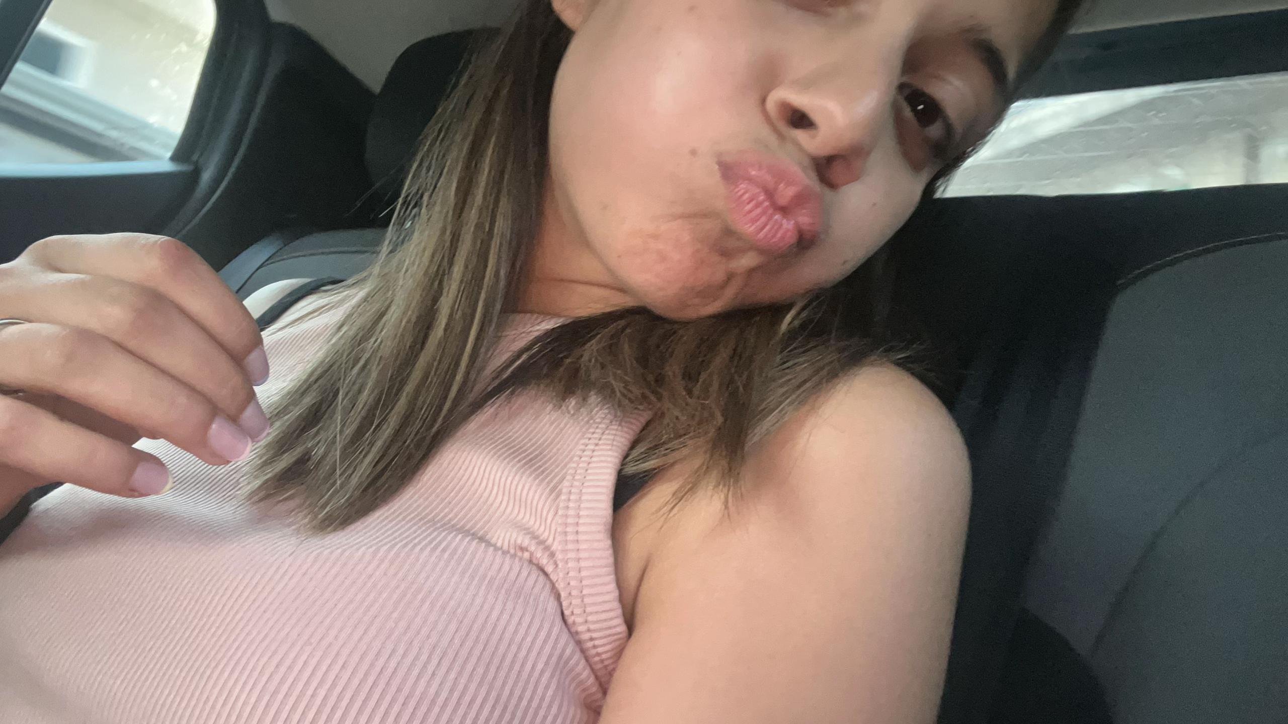 @Noemi