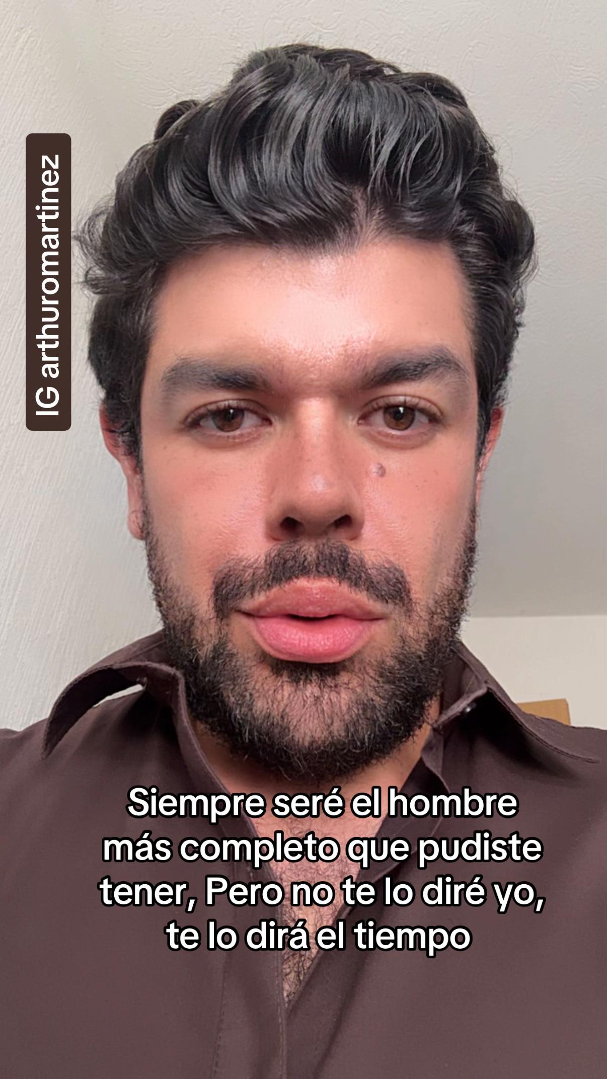 @Arturo Martinez