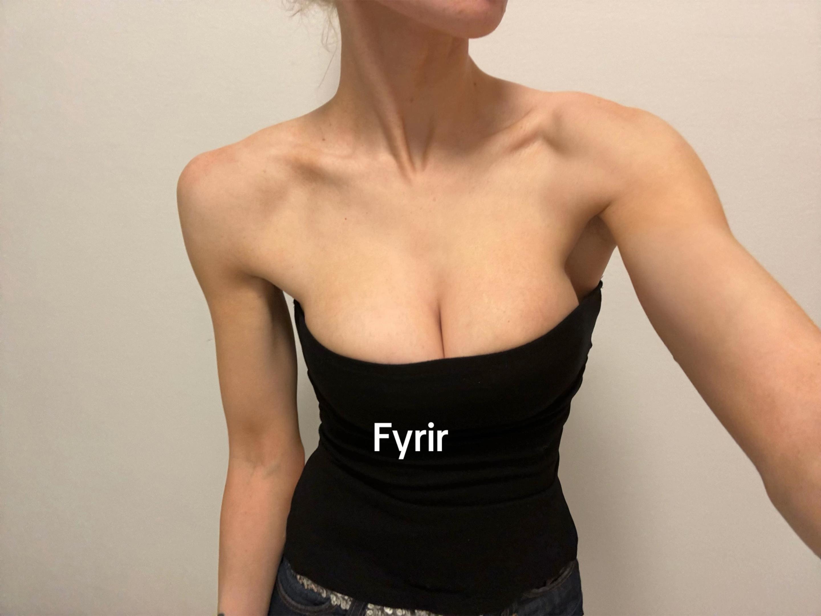 @Brynhildur gunnlaugs