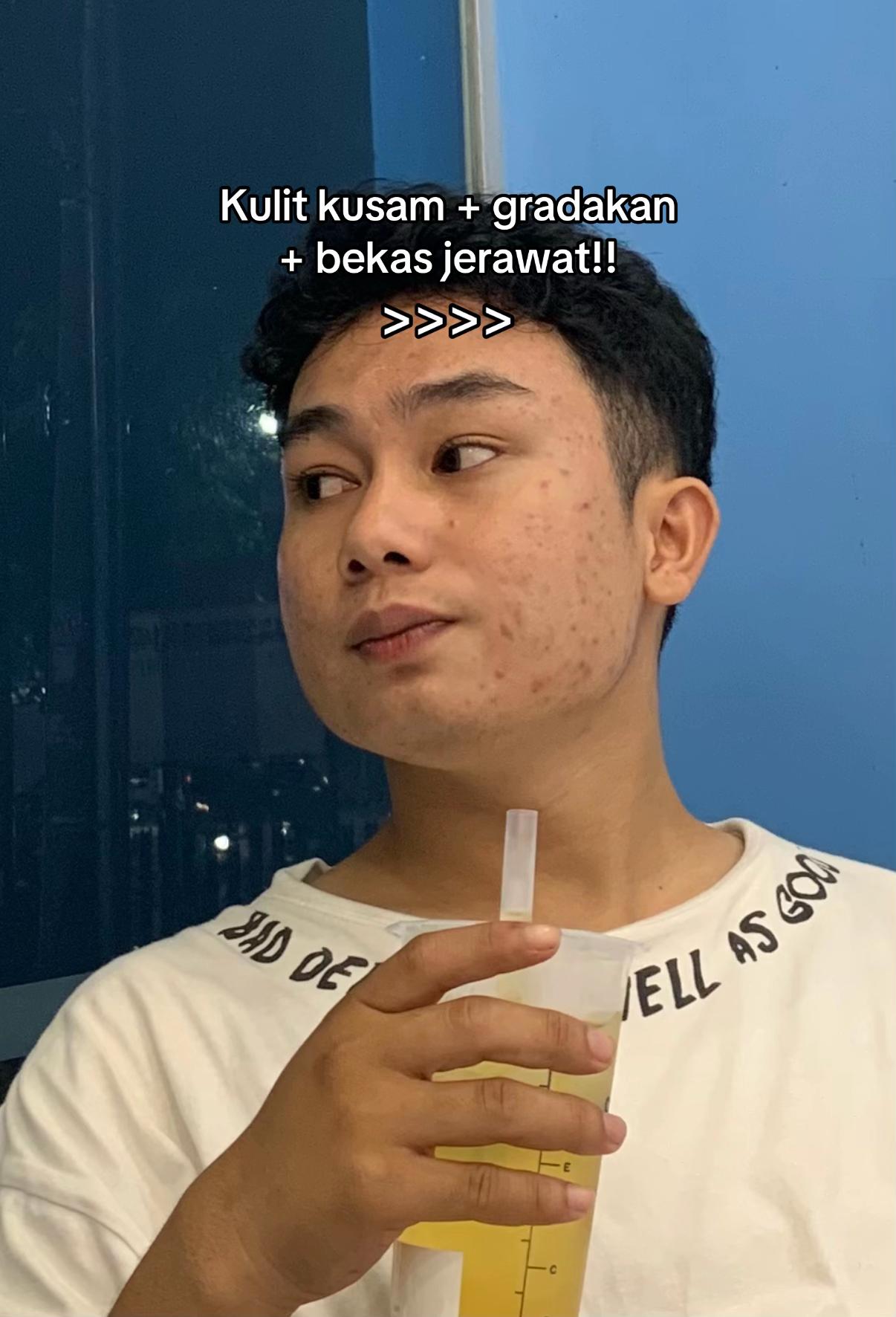 @Muekkk