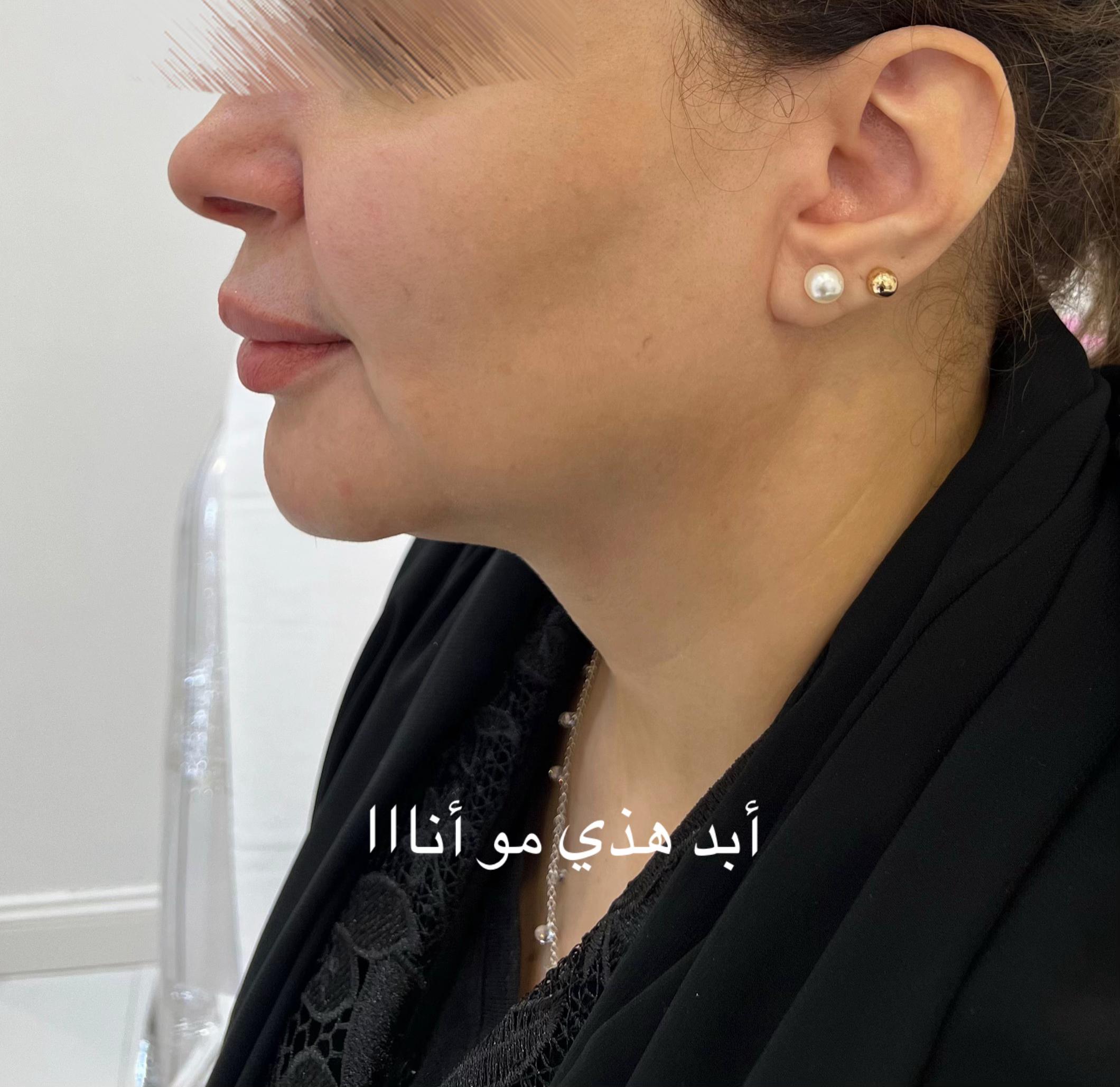 @Elegant Clinic | عيادات اليقنت
