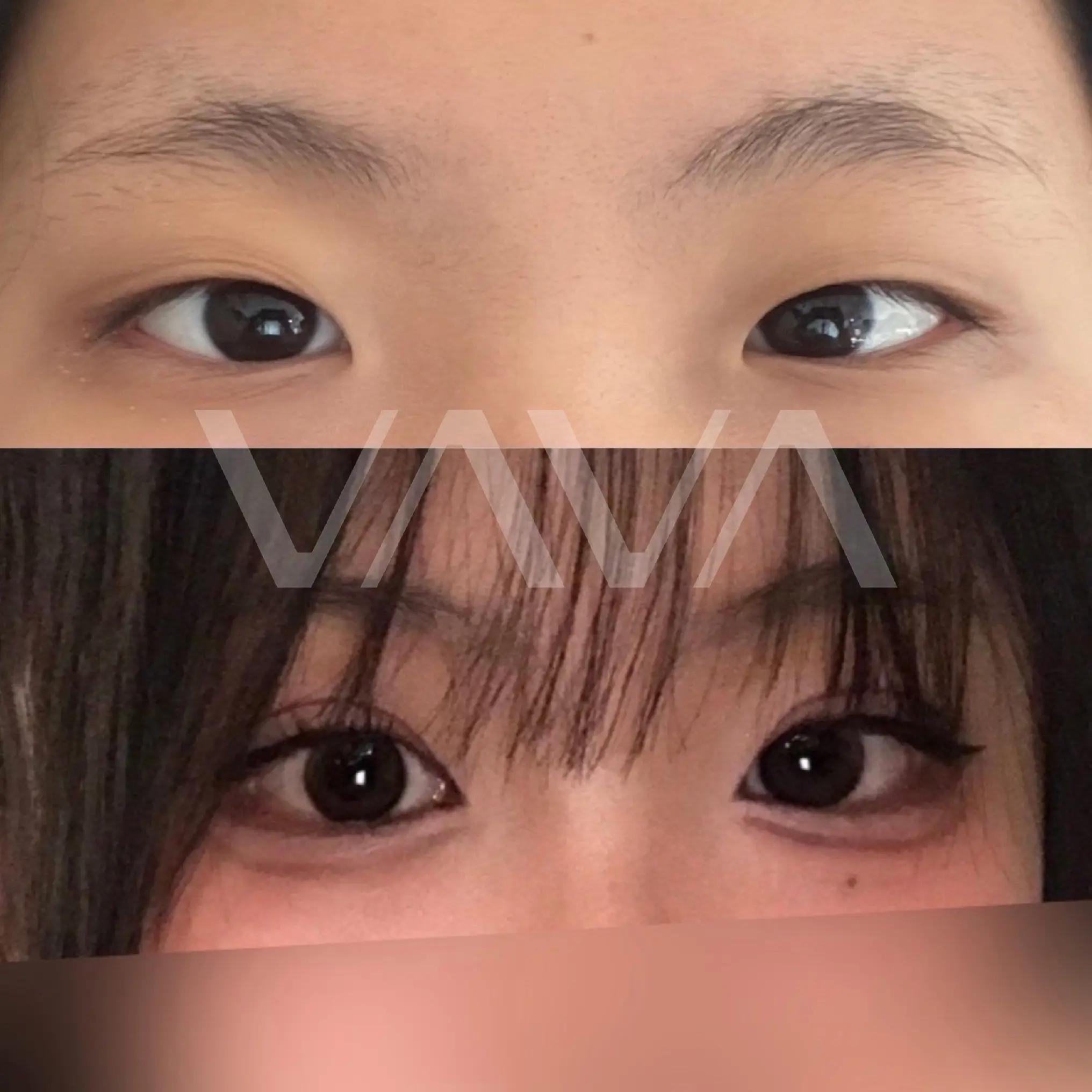 @VAVA美容整形外科