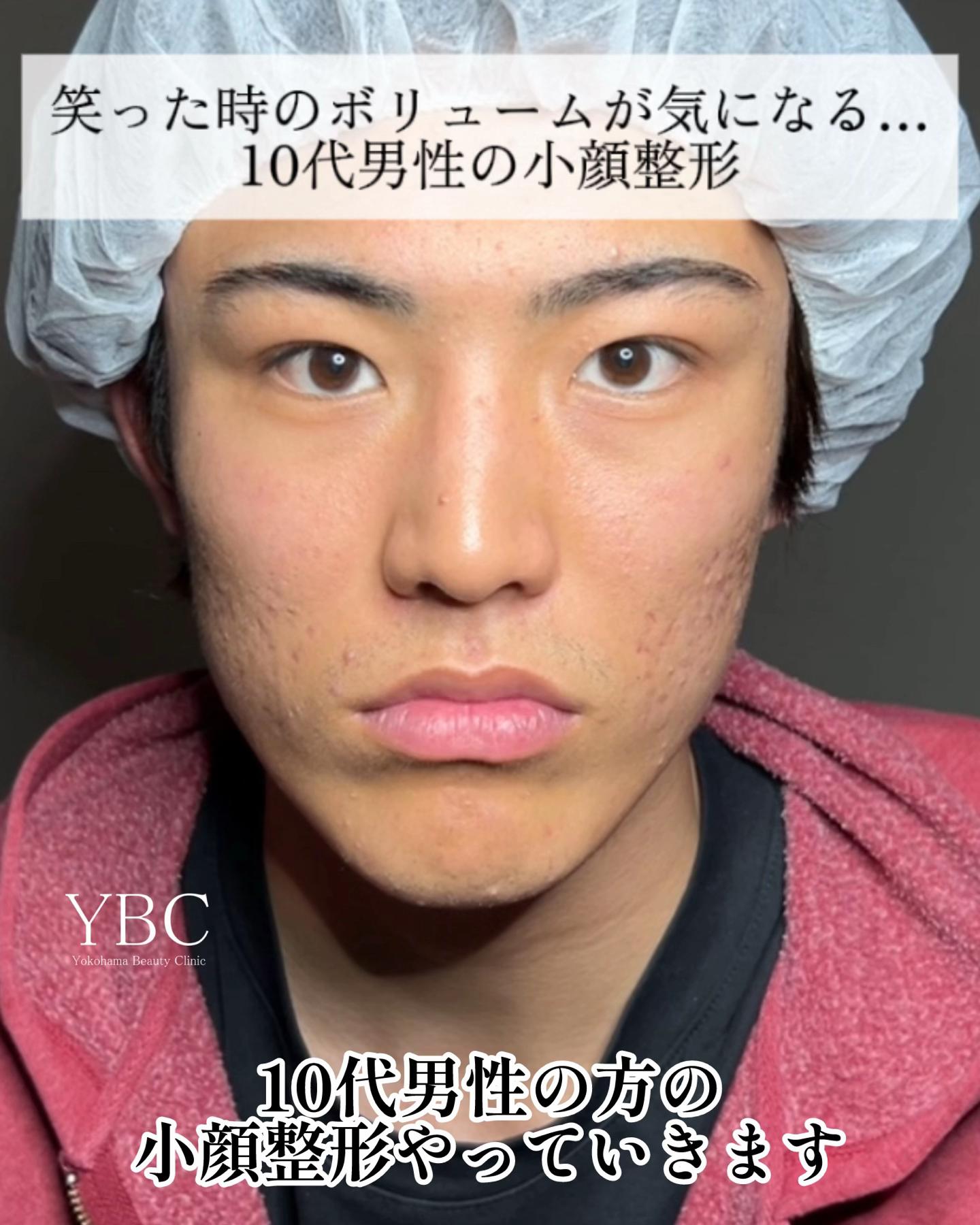 @イソセン/美容外科医（磯村亮輔院長）