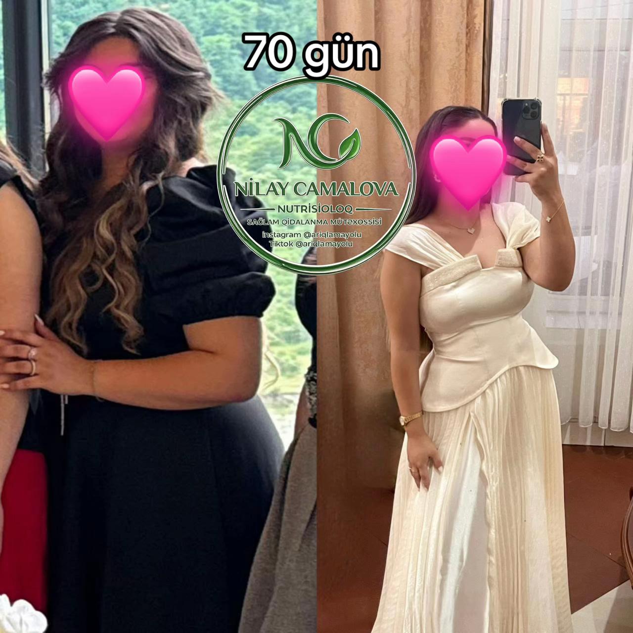 @Nutrisioloq Nilay Camalova 🥑
