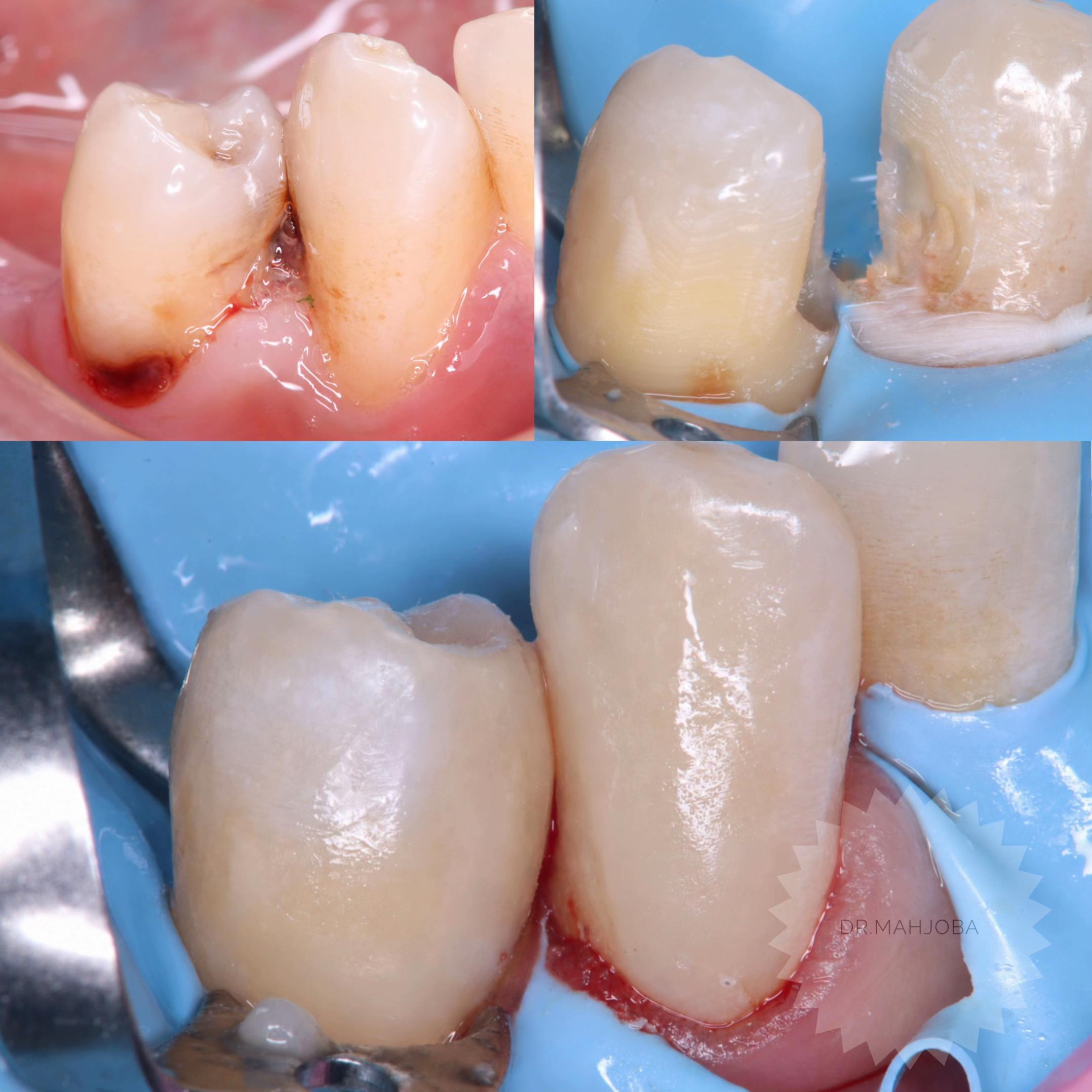 @Dr.Noor Mahjoba👩🏻⚕️🦷💉💎