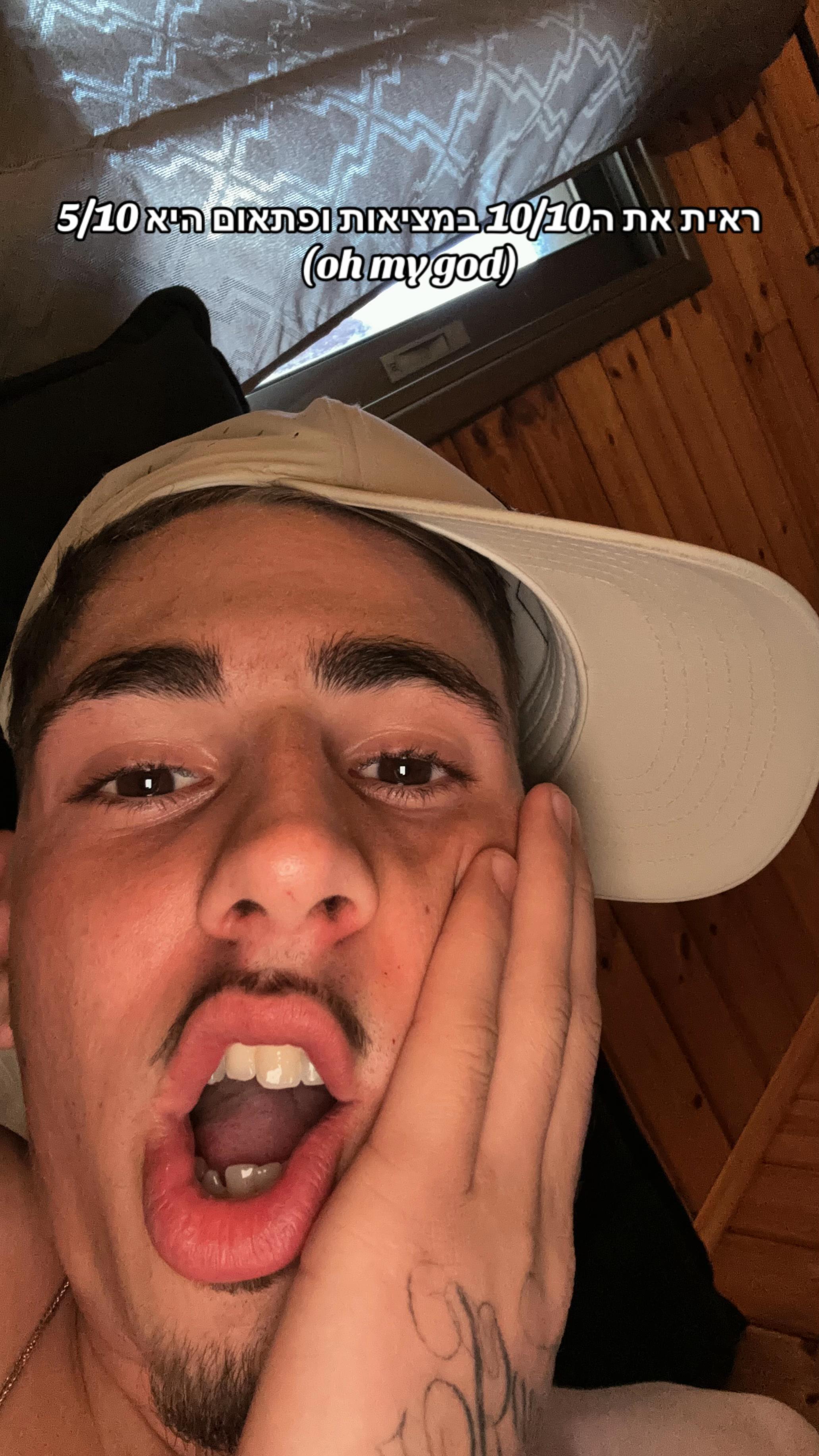 @777