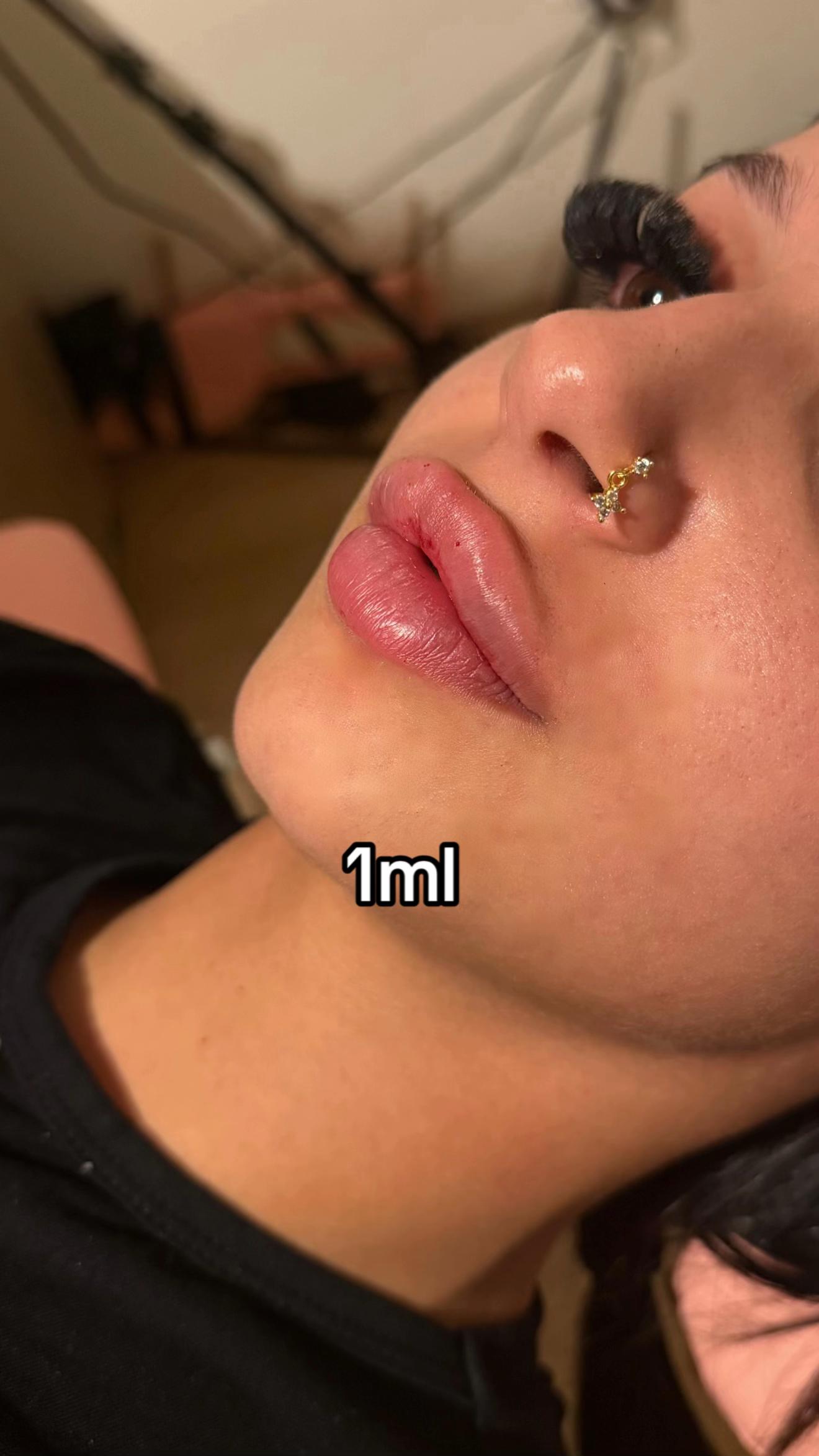 @DOLLS INJECTION 🫦