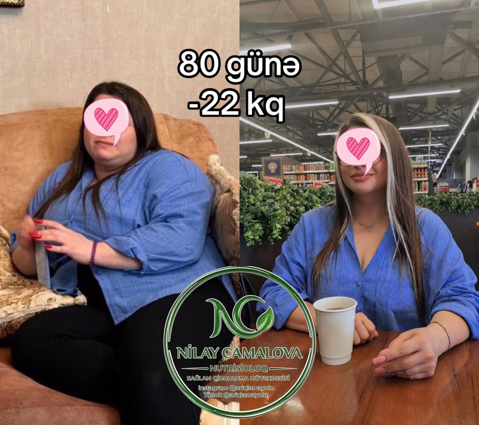 @Nutrisioloq Nilay Camalova 🥑