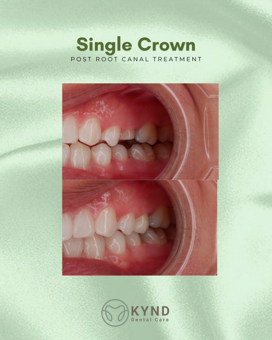 @KYND Dental Care |Dentist BALI