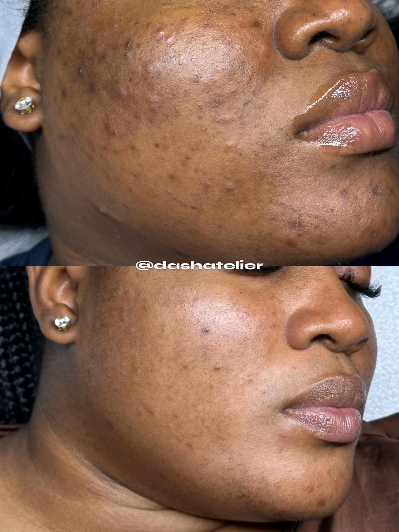 @MONTREAL SKINCARE SPECIALIST