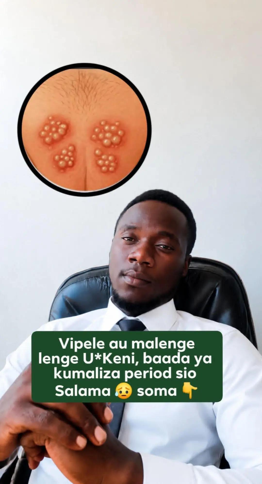 @IC Uzazi zone na Doc Chalamila