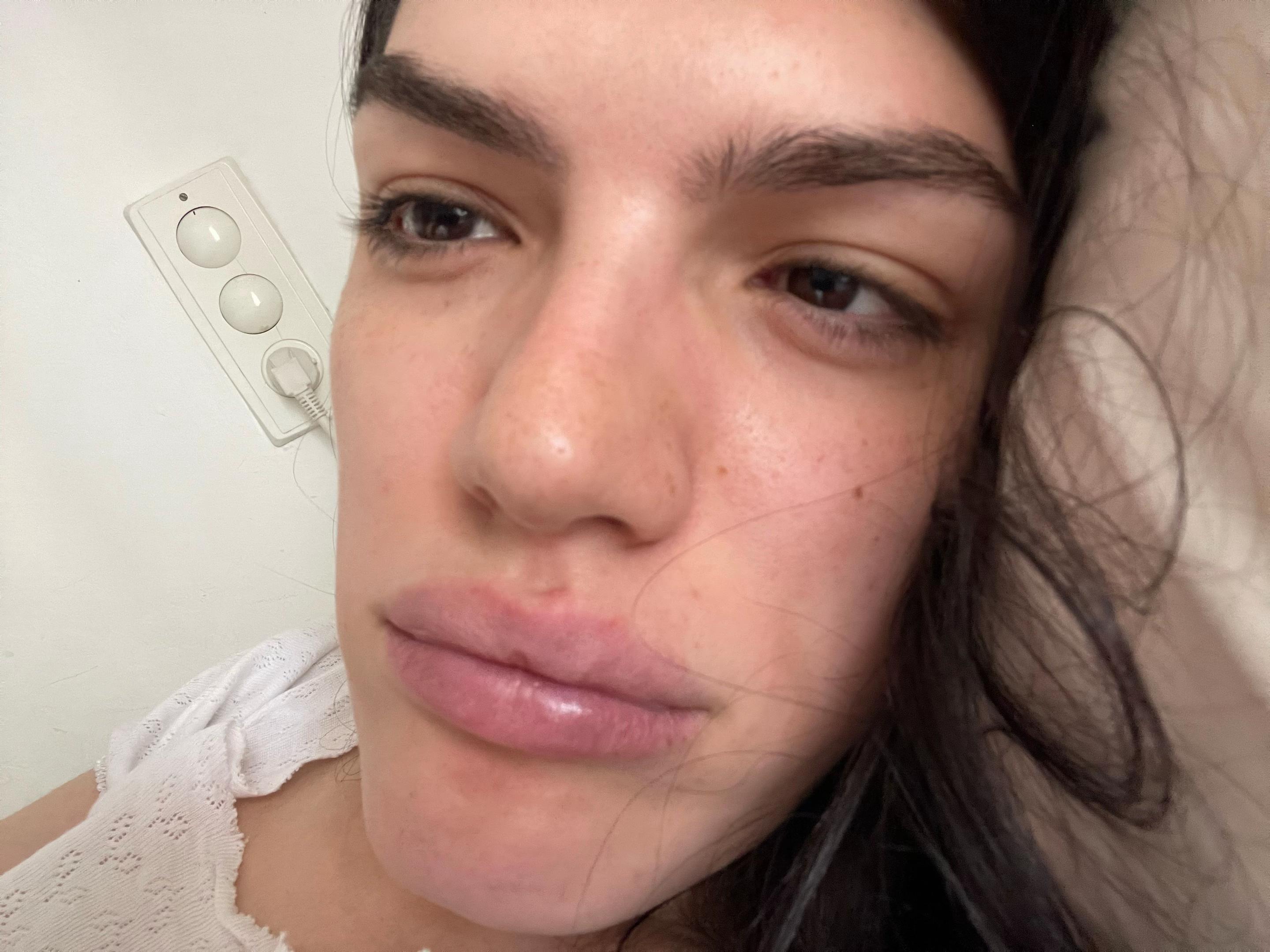 @Rub&iacute;