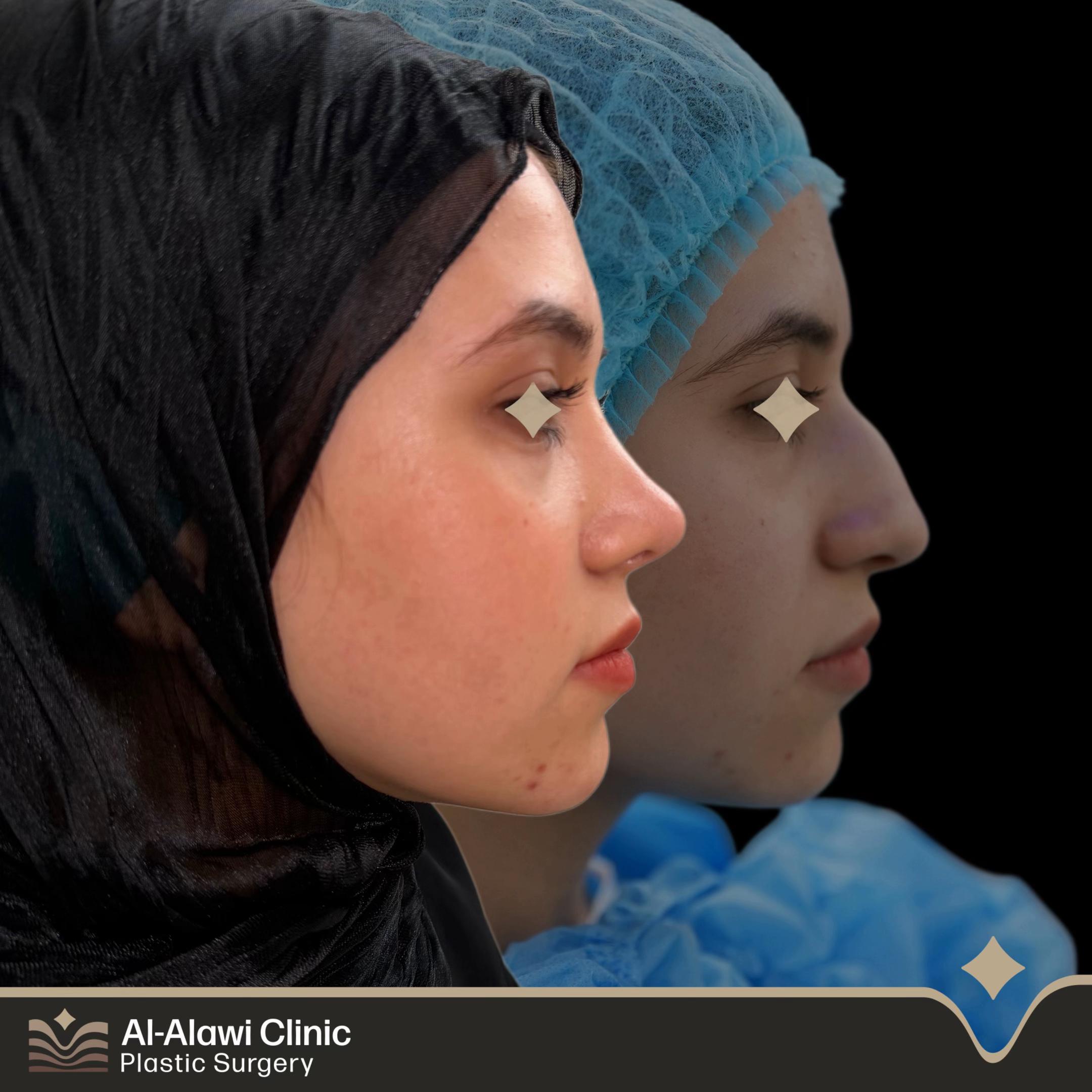 @dr.mhmd.alalawi