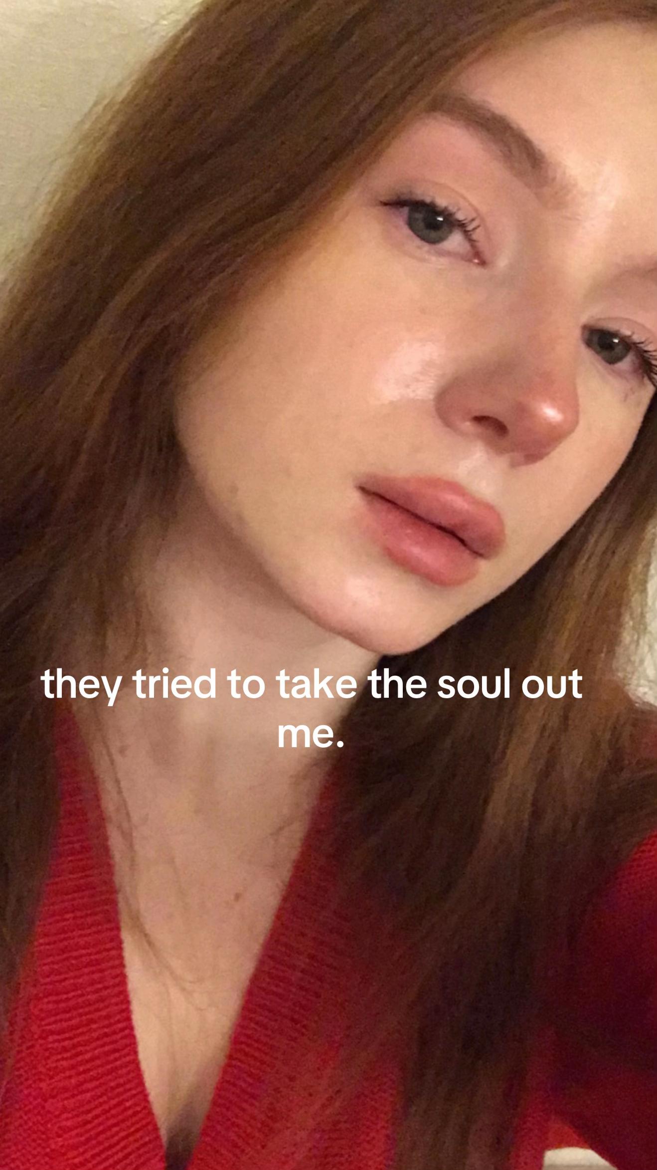 @Goldcherryy